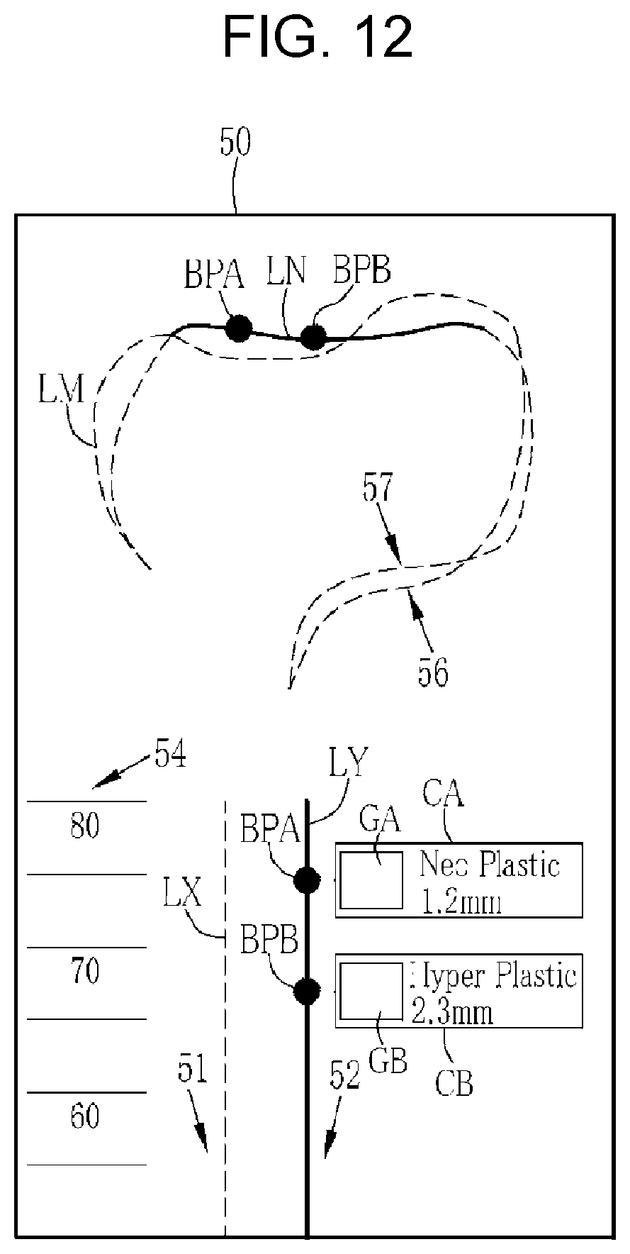 Patent US12569116 Figure 6 – Processor device, operation method of processor device, non-transitory computer readable medium, and endoscope system for displaying movement trajectory of endoscope