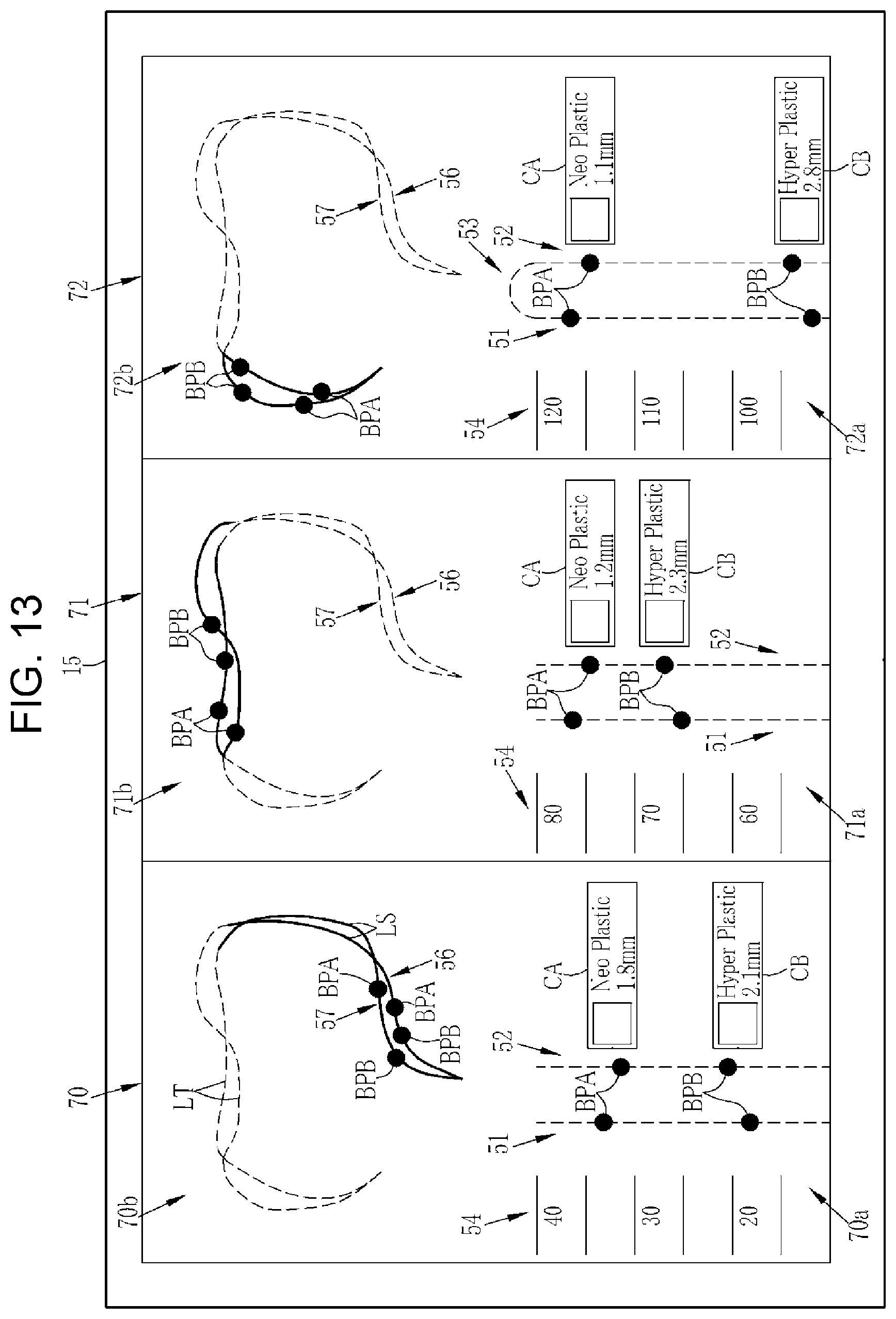 Patent US12569116 Figure 7 – Processor device, operation method of processor device, non-transitory computer readable medium, and endoscope system for displaying movement trajectory of endoscope