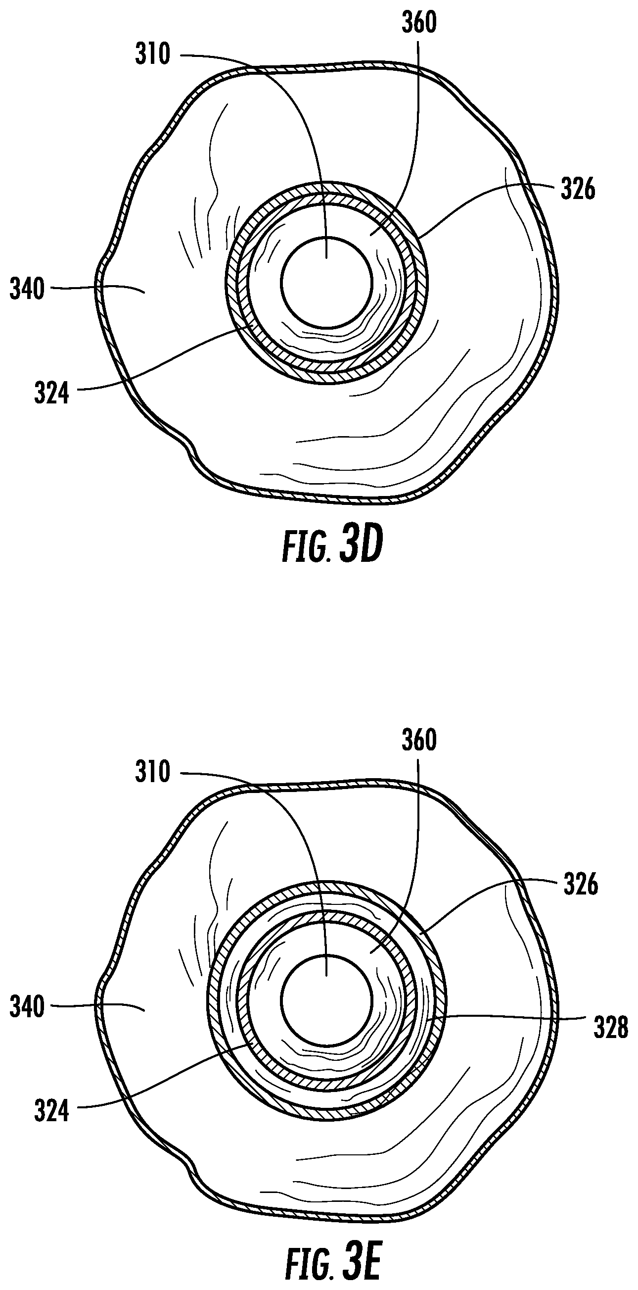 Patent US12569123 Figure 7 – Expandable guide devices, systems, and methods