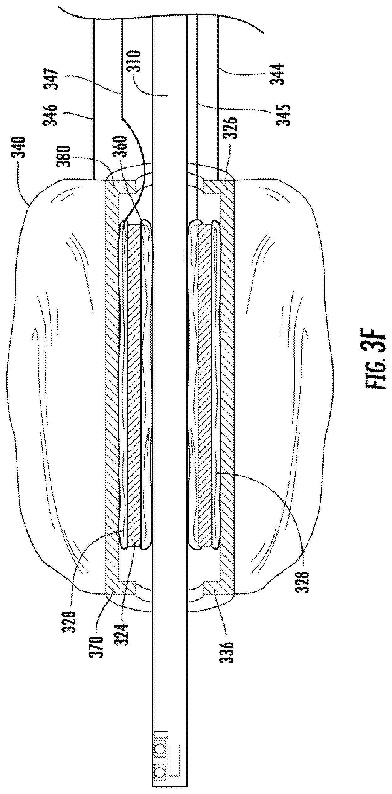 Patent US12569123 Figure 8 – Expandable guide devices, systems, and methods