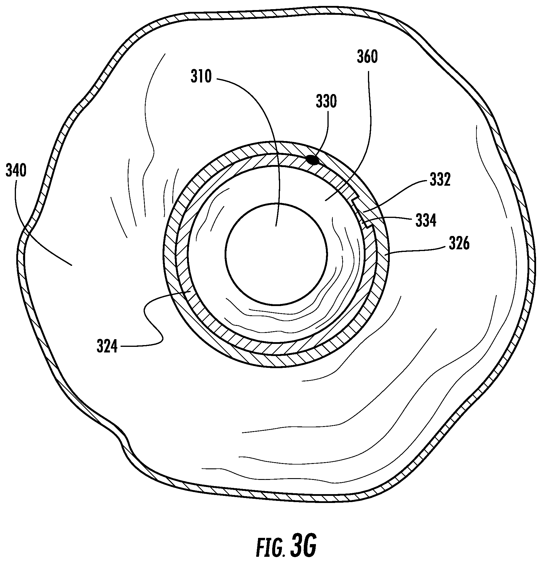 Patent US12569123 Figure 9 – Expandable guide devices, systems, and methods