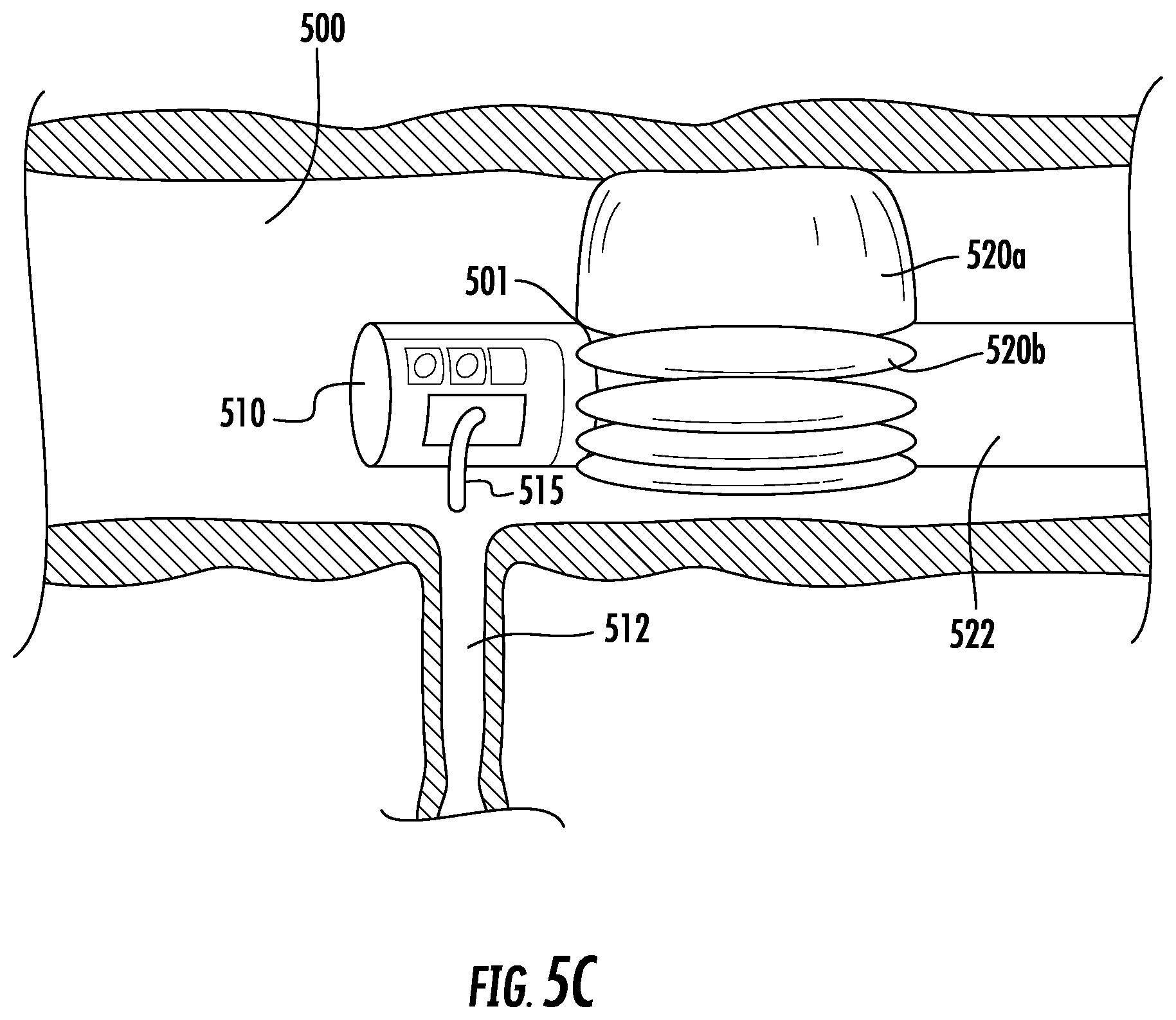 Patent US12569123 Figure 12 – Expandable guide devices, systems, and methods