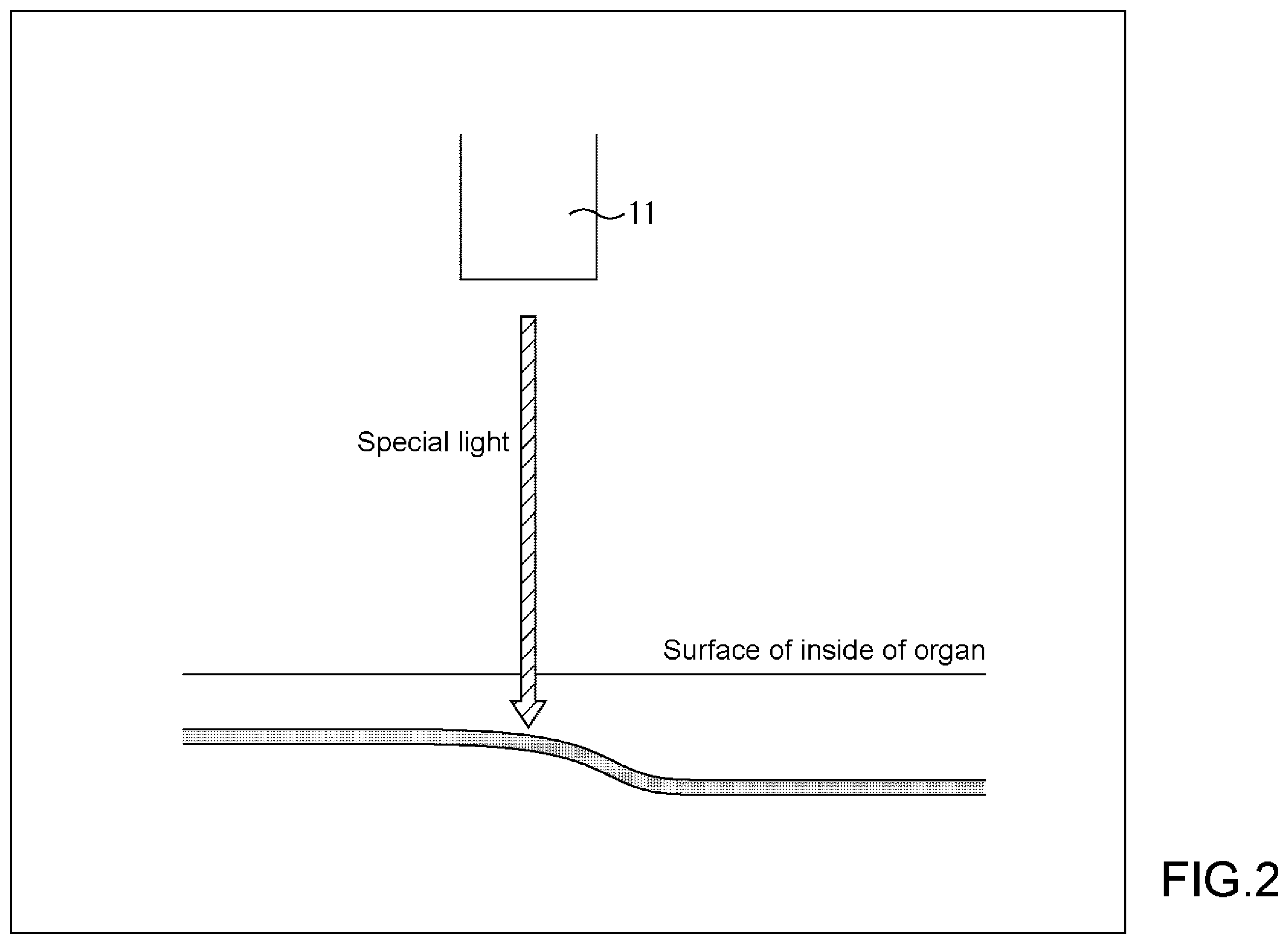 Patent US12569125 Figure 2 – Medical imaging system, medical imaging processing method, and medical information processing apparatus