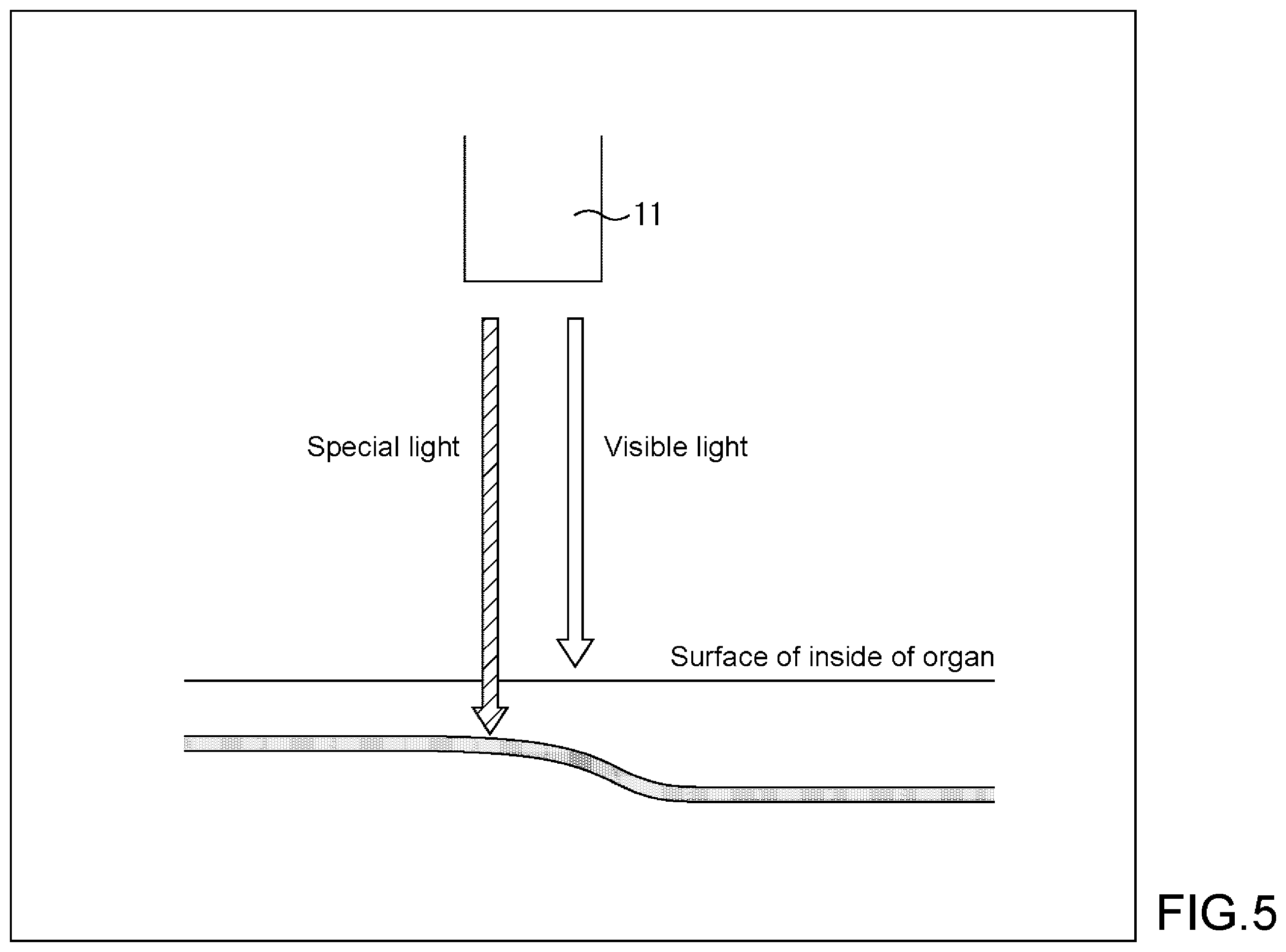 Patent US12569125 Figure 5 – Medical imaging system, medical imaging processing method, and medical information processing apparatus