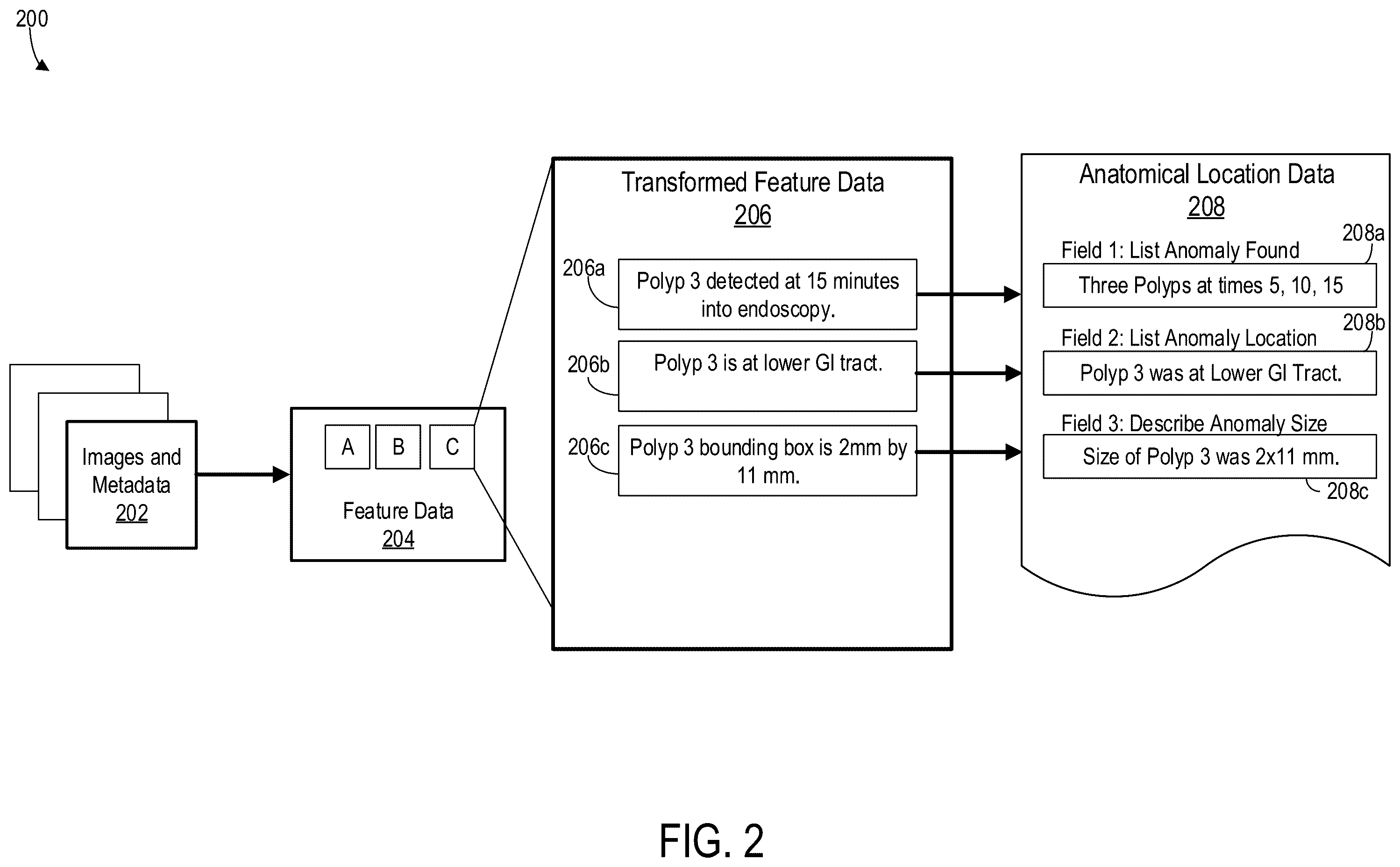 Patent US12569129 Figure 4 – Anatomical location detection of features of a gastrointestinal tract of a patient