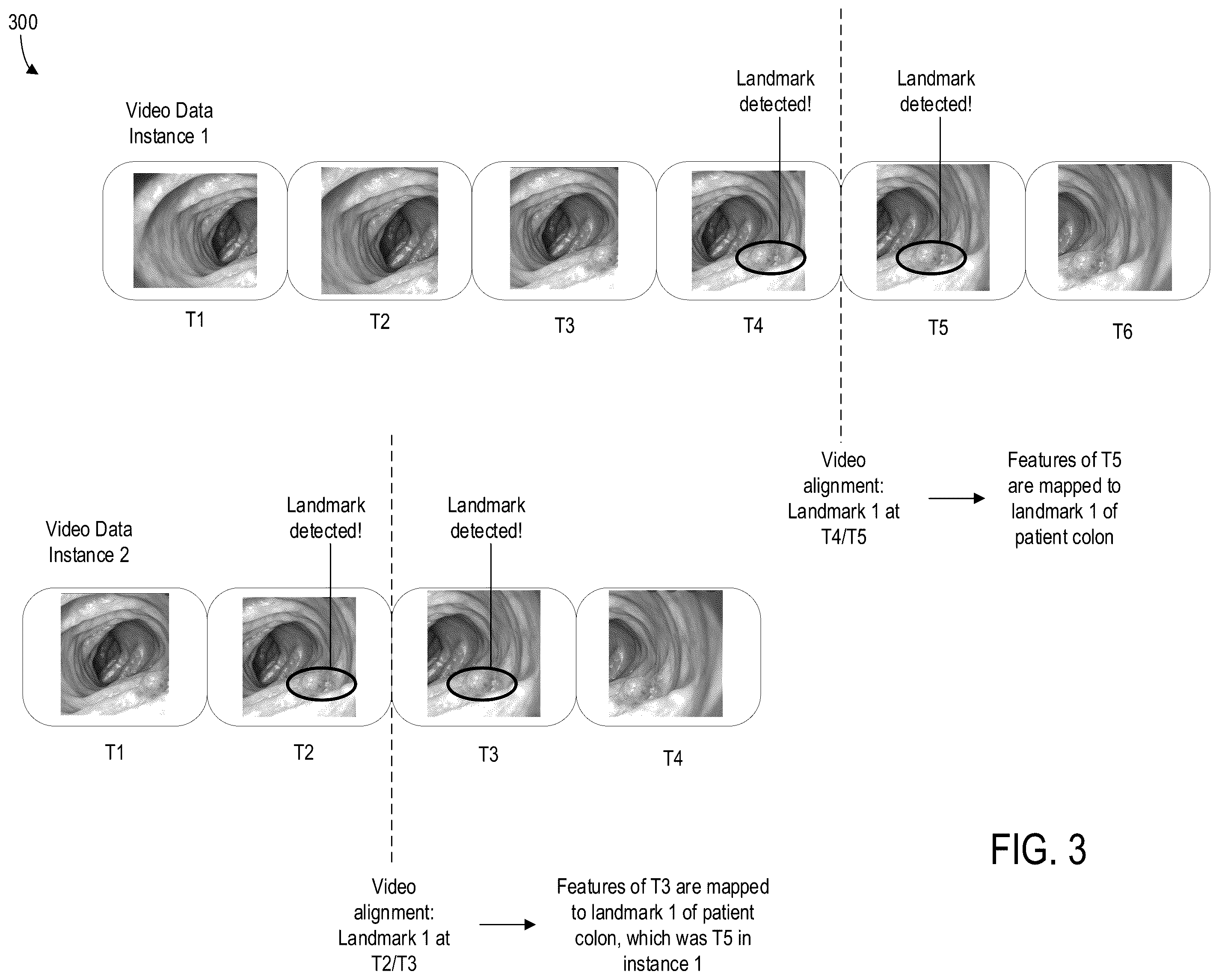 Patent US12569129 Figure 5 – Anatomical location detection of features of a gastrointestinal tract of a patient