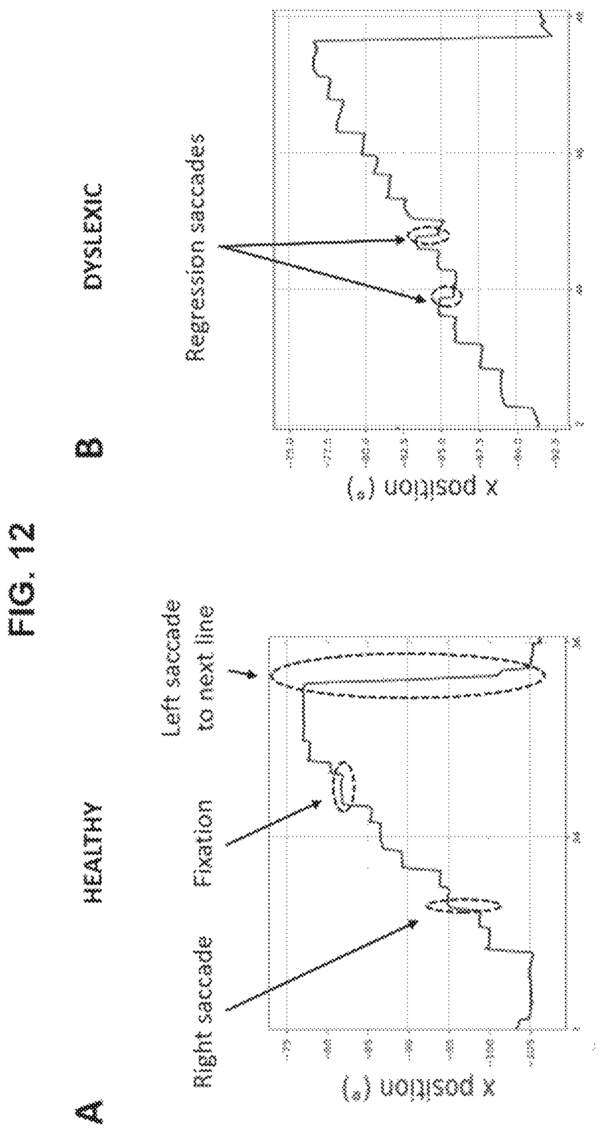Patent US12569132 Figure 14 – Analysis of eye movements in 3D real space in direction and depth
