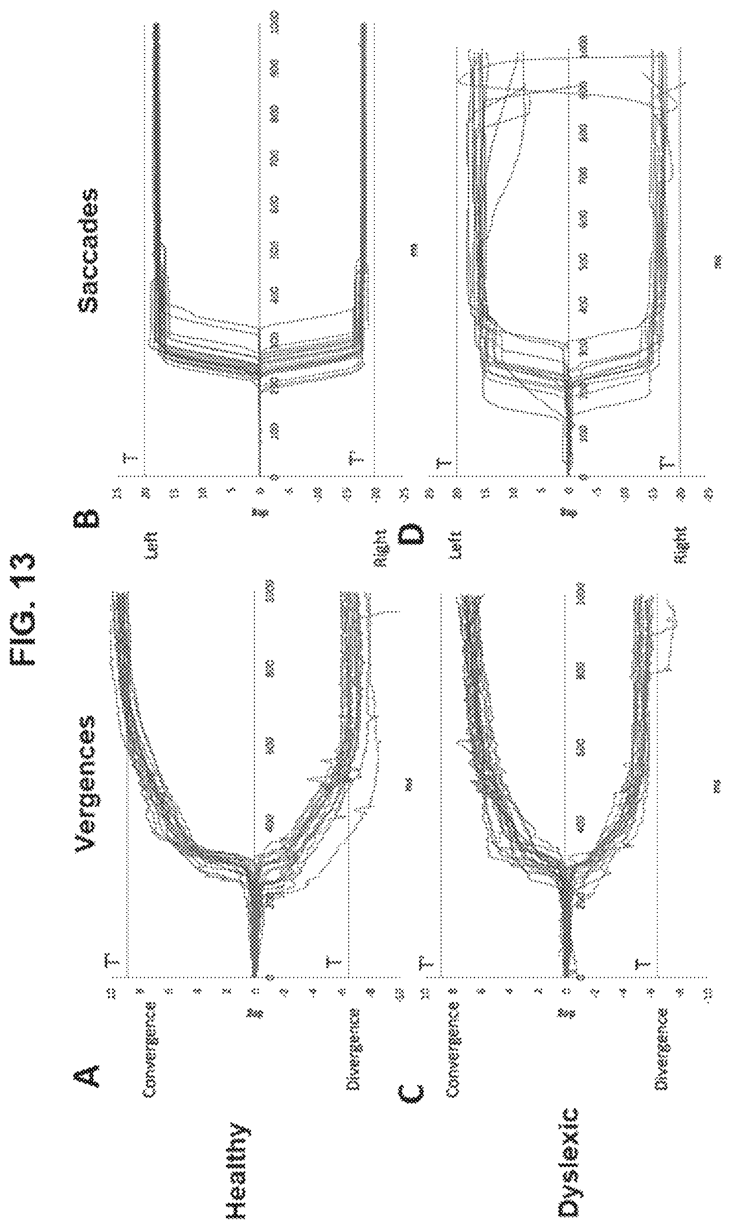 Patent US12569132 Figure 15 – Analysis of eye movements in 3D real space in direction and depth