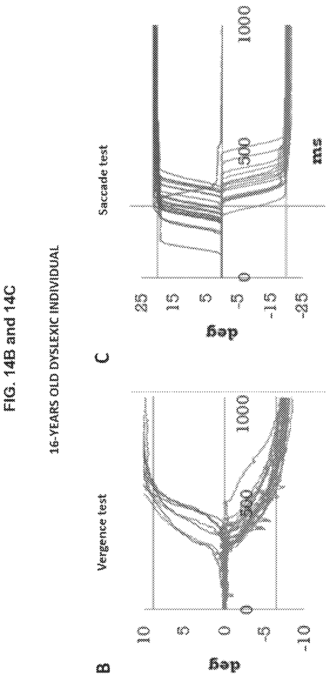 Patent US12569132 Figure 17 – Analysis of eye movements in 3D real space in direction and depth
