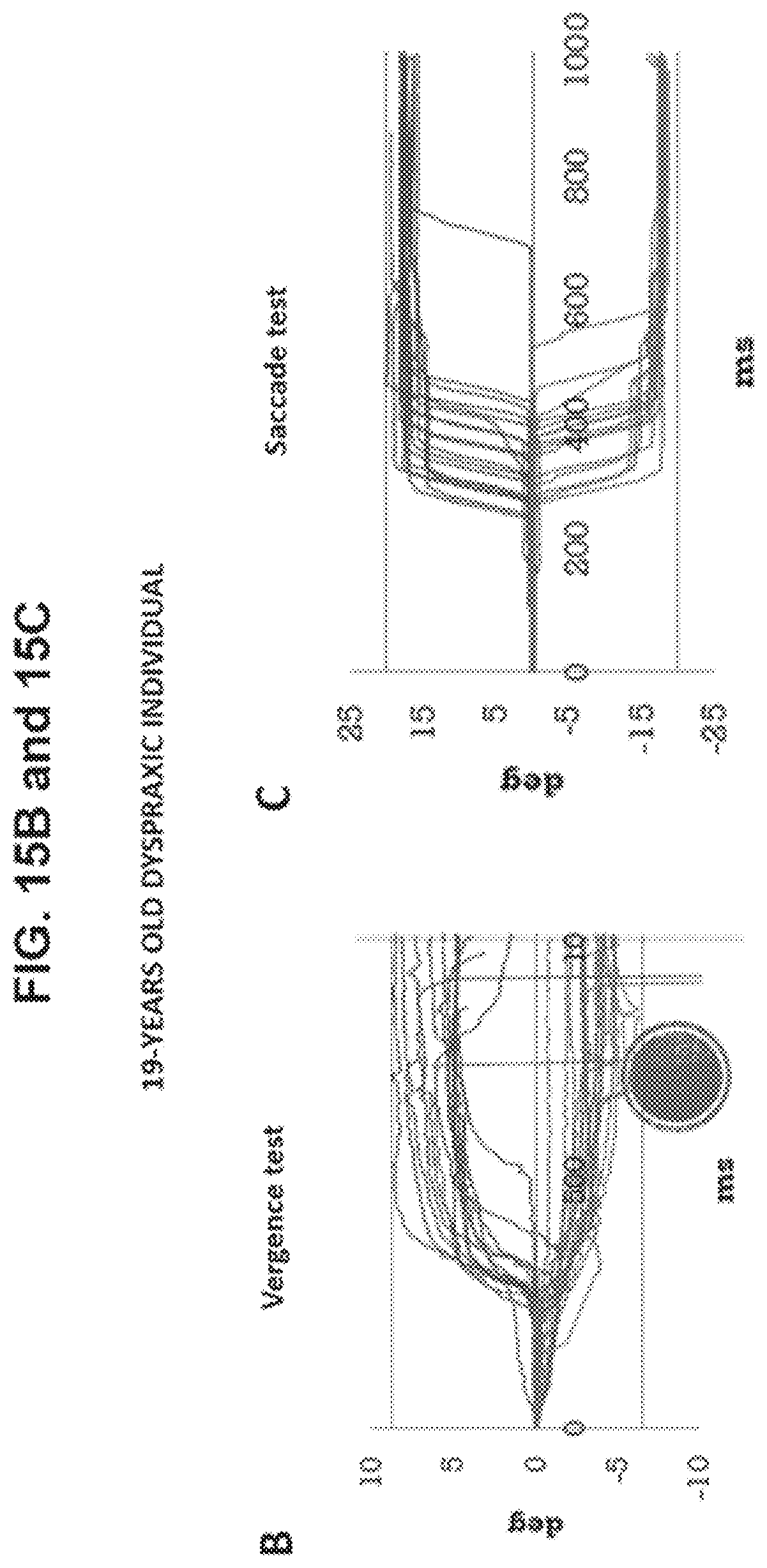 Patent US12569132 Figure 20 – Analysis of eye movements in 3D real space in direction and depth