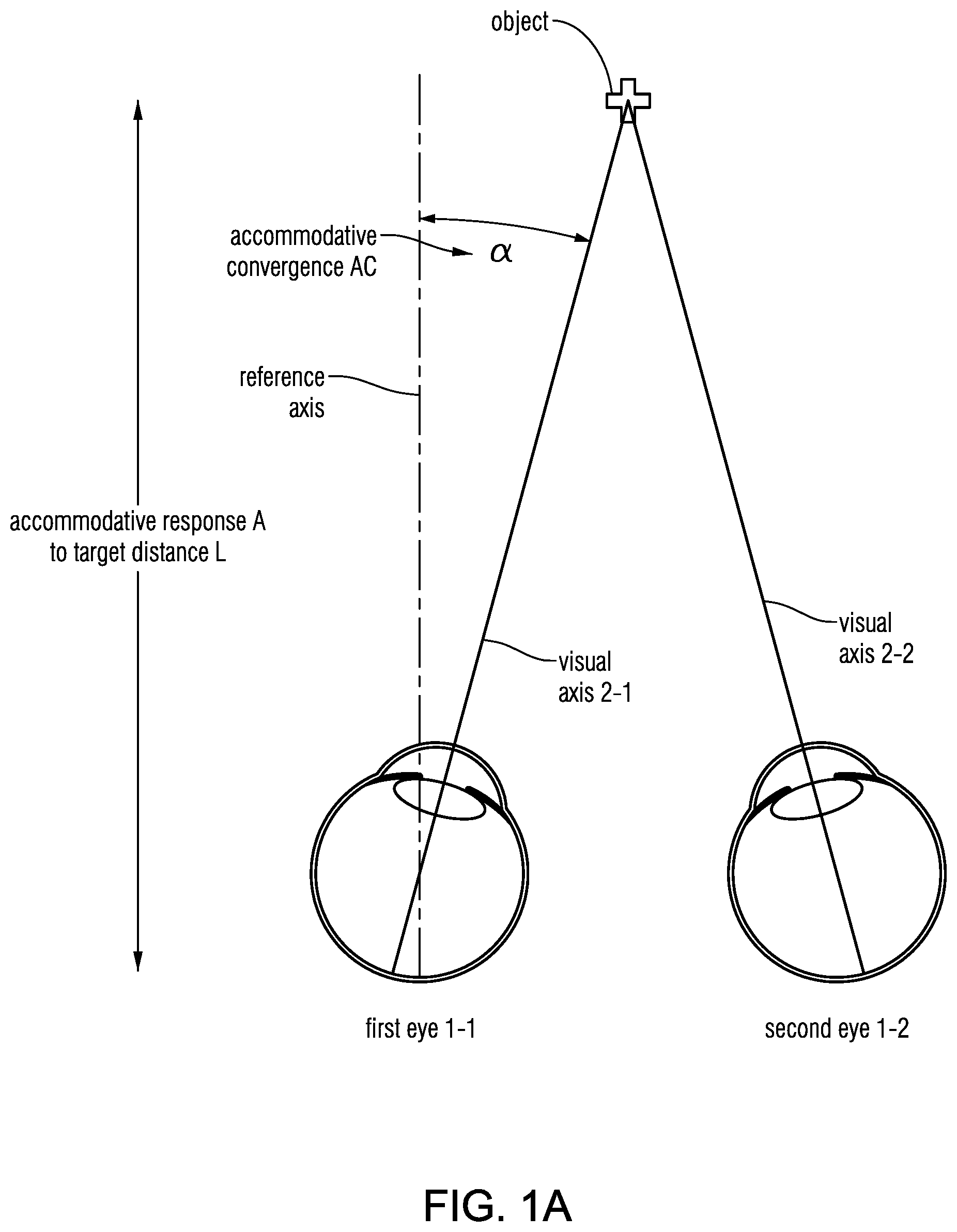 Patent US12569135 Figure 1 – Headset-based system for measuring binocular alignment
