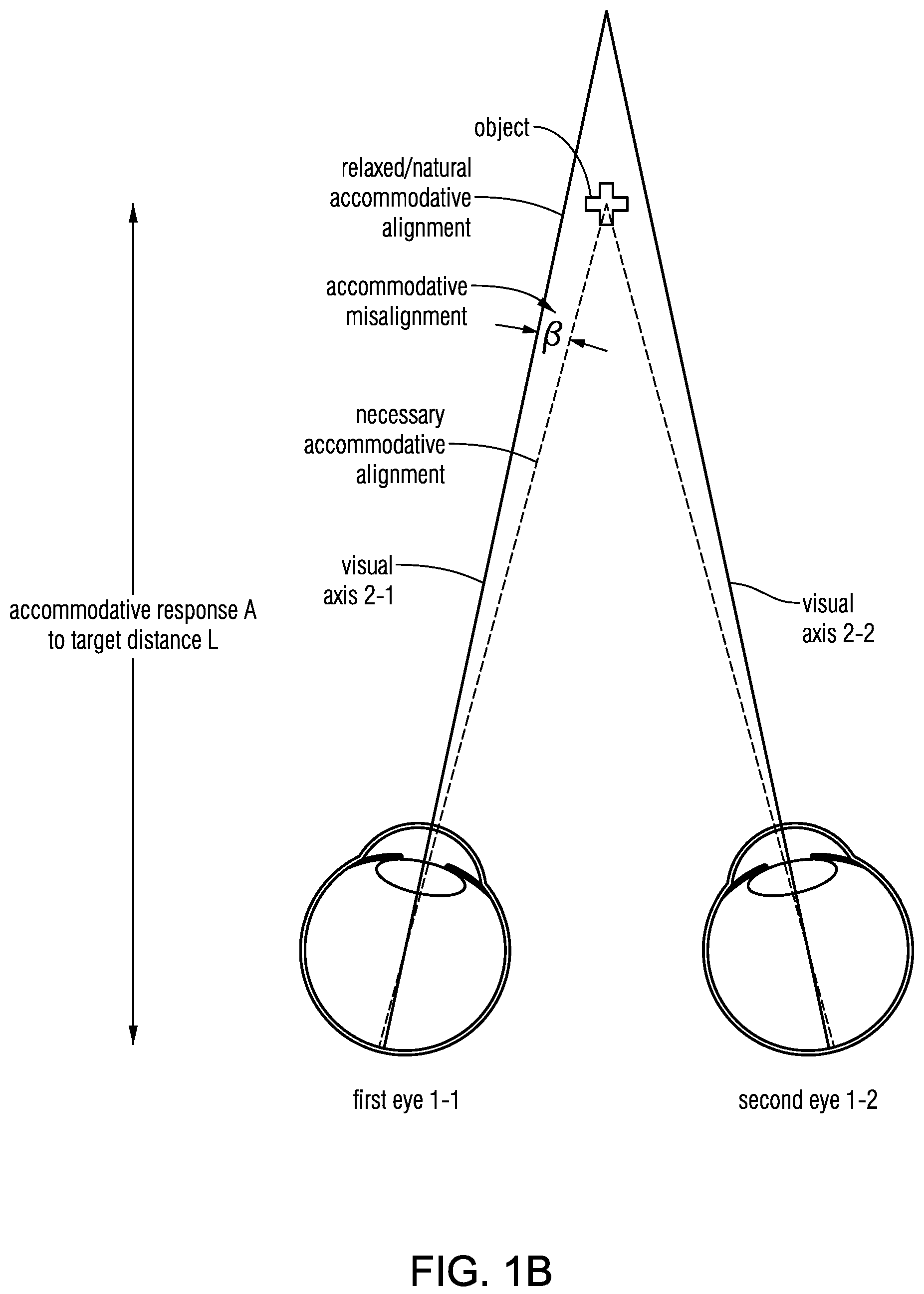 Patent US12569135 Figure 2 – Headset-based system for measuring binocular alignment