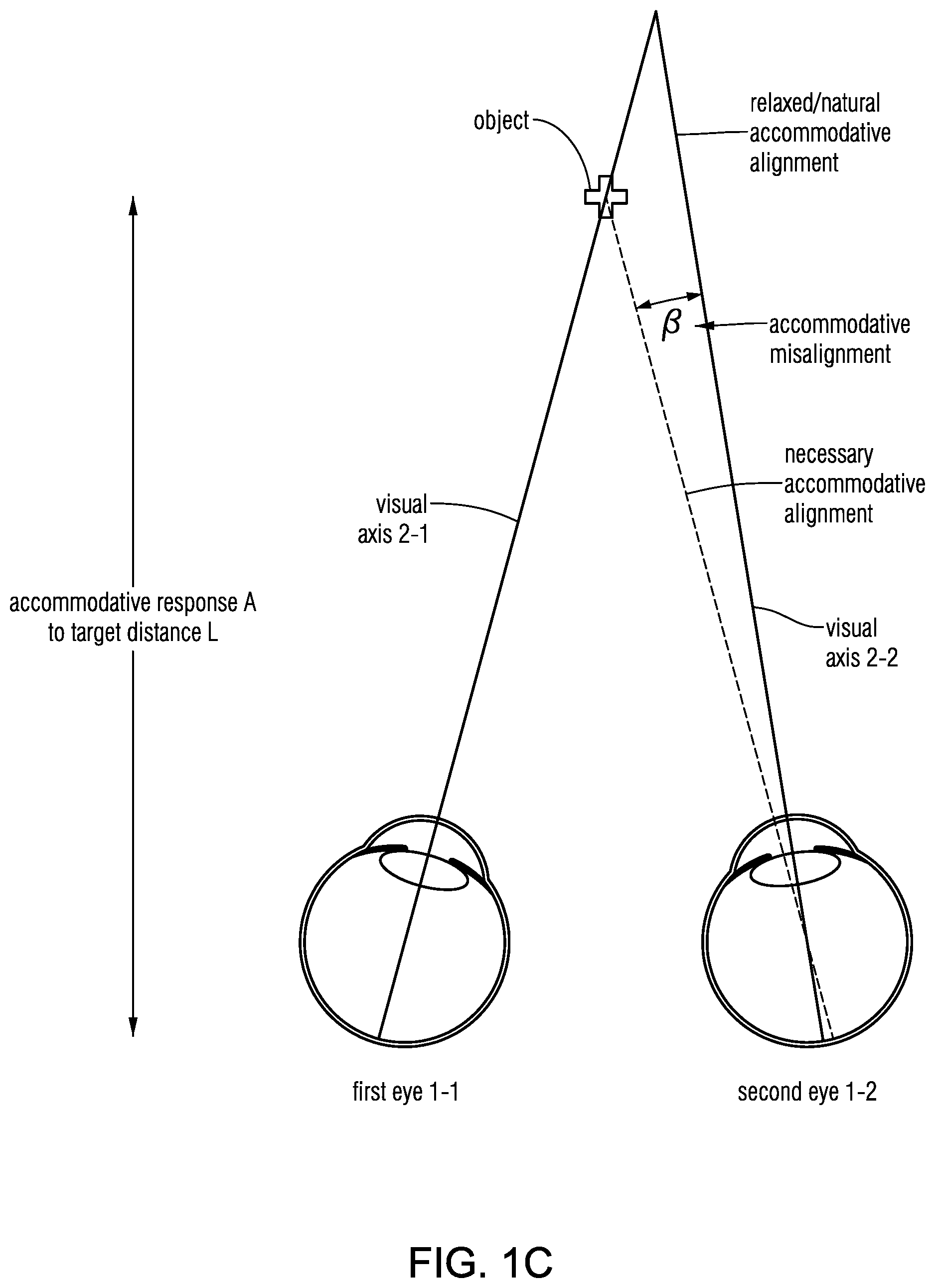 Patent US12569135 Figure 3 – Headset-based system for measuring binocular alignment