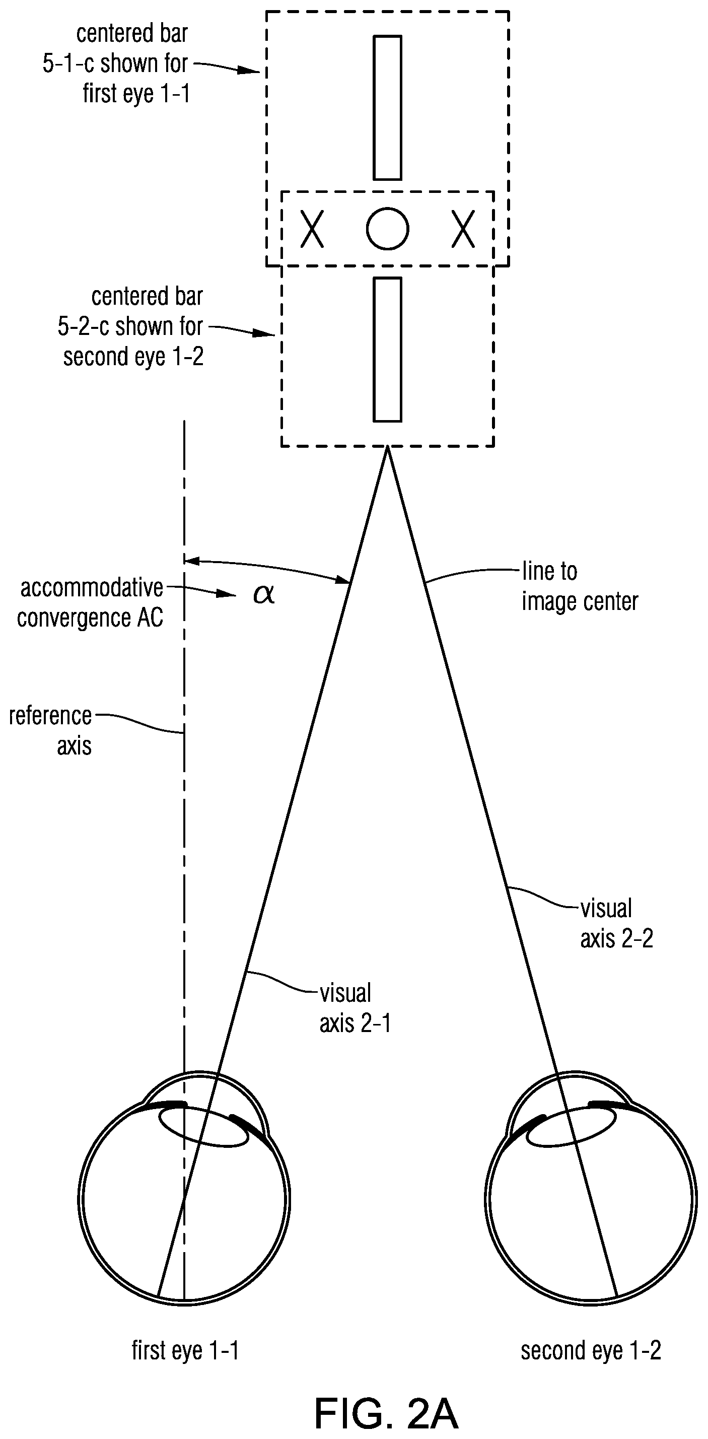 Patent US12569135 Figure 4 – Headset-based system for measuring binocular alignment