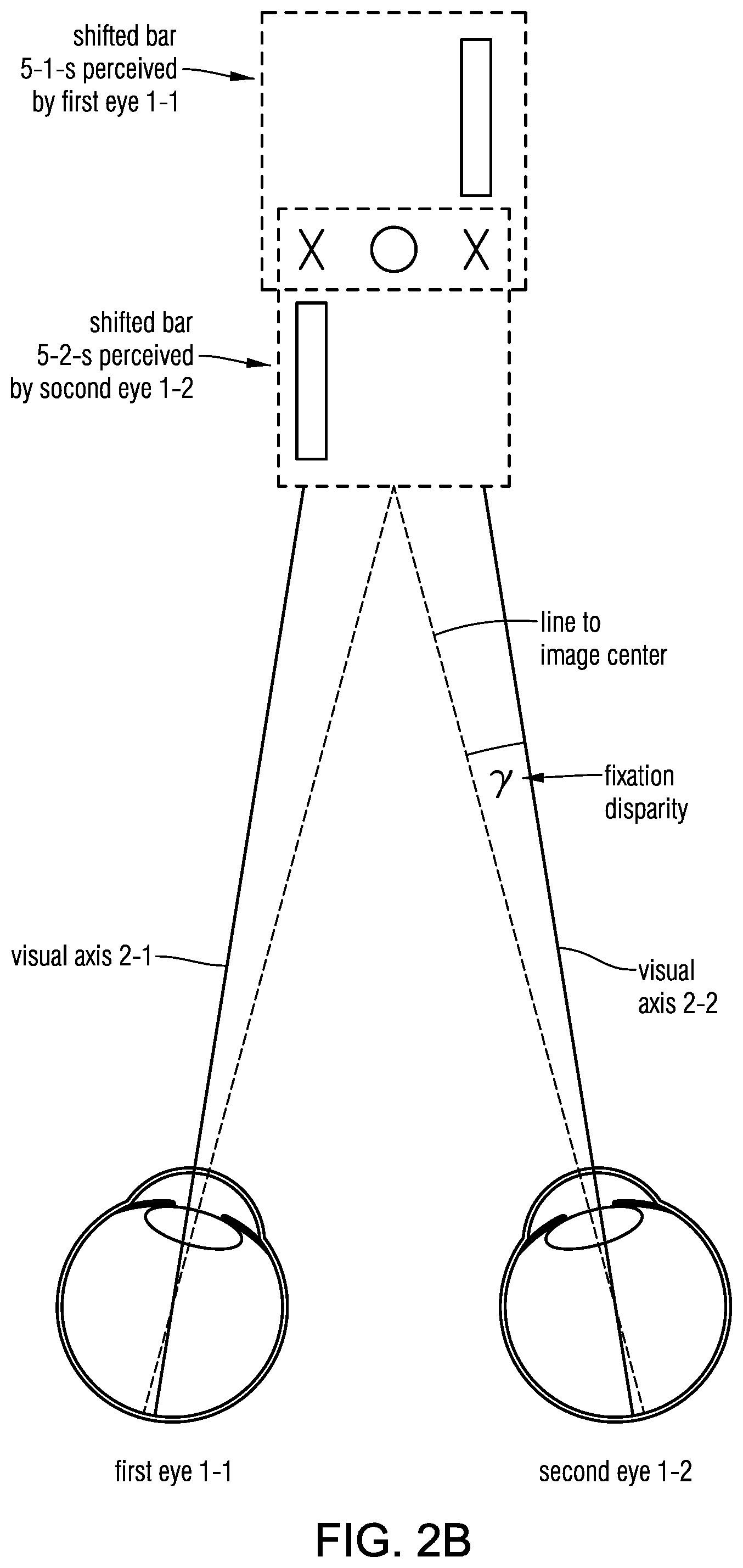 Patent US12569135 Figure 5 – Headset-based system for measuring binocular alignment