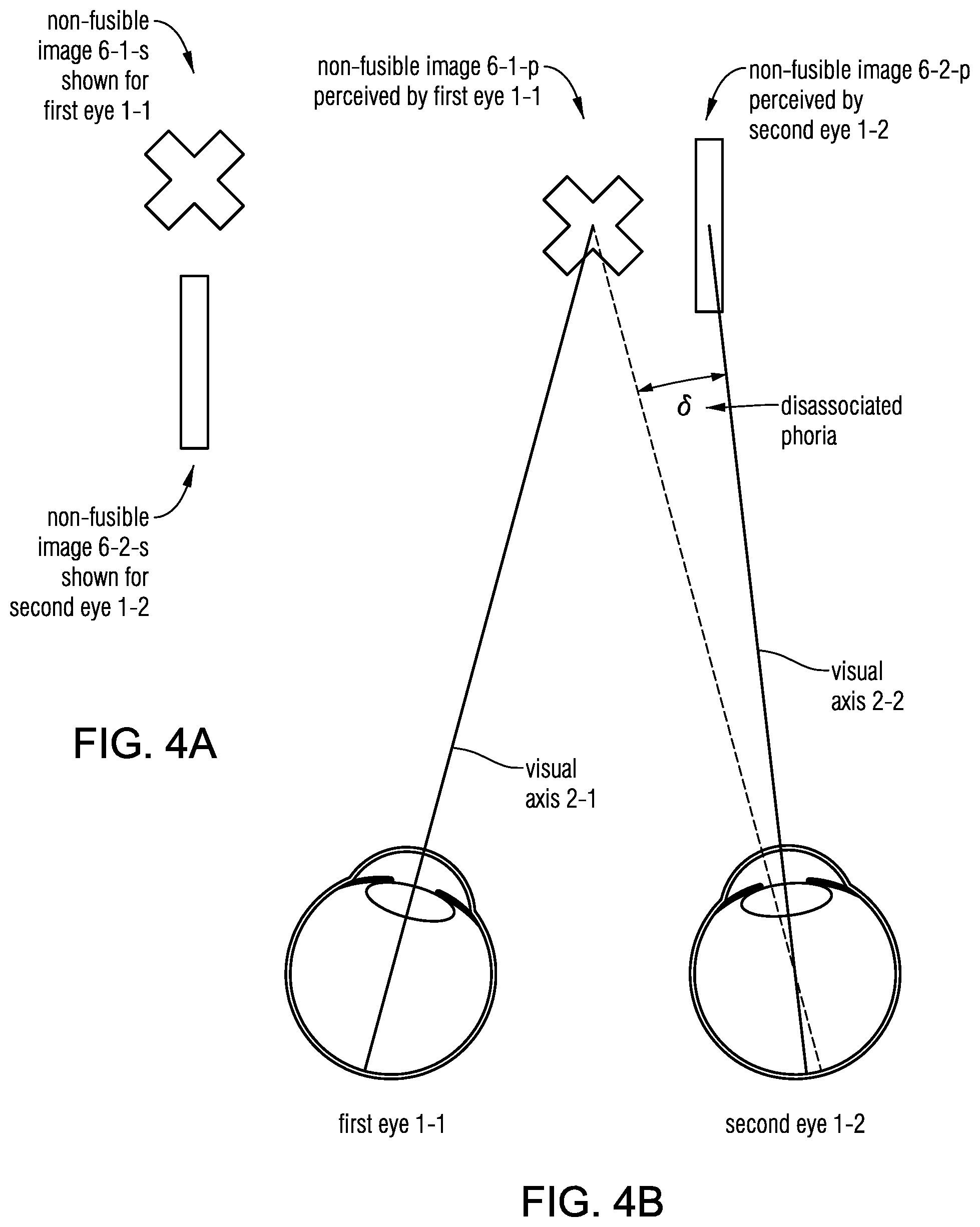 Patent US12569135 Figure 9 – Headset-based system for measuring binocular alignment