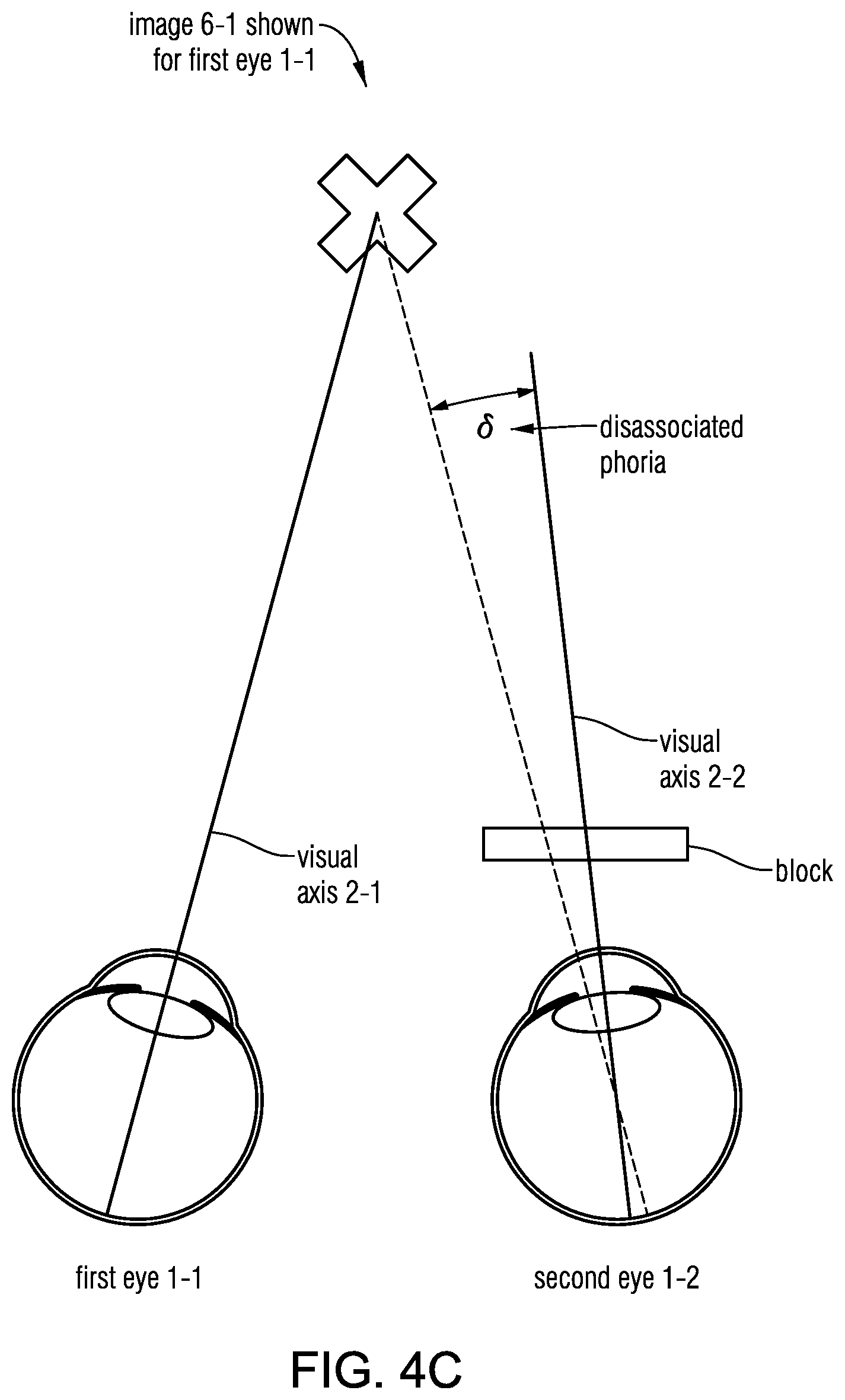 Patent US12569135 Figure 10 – Headset-based system for measuring binocular alignment
