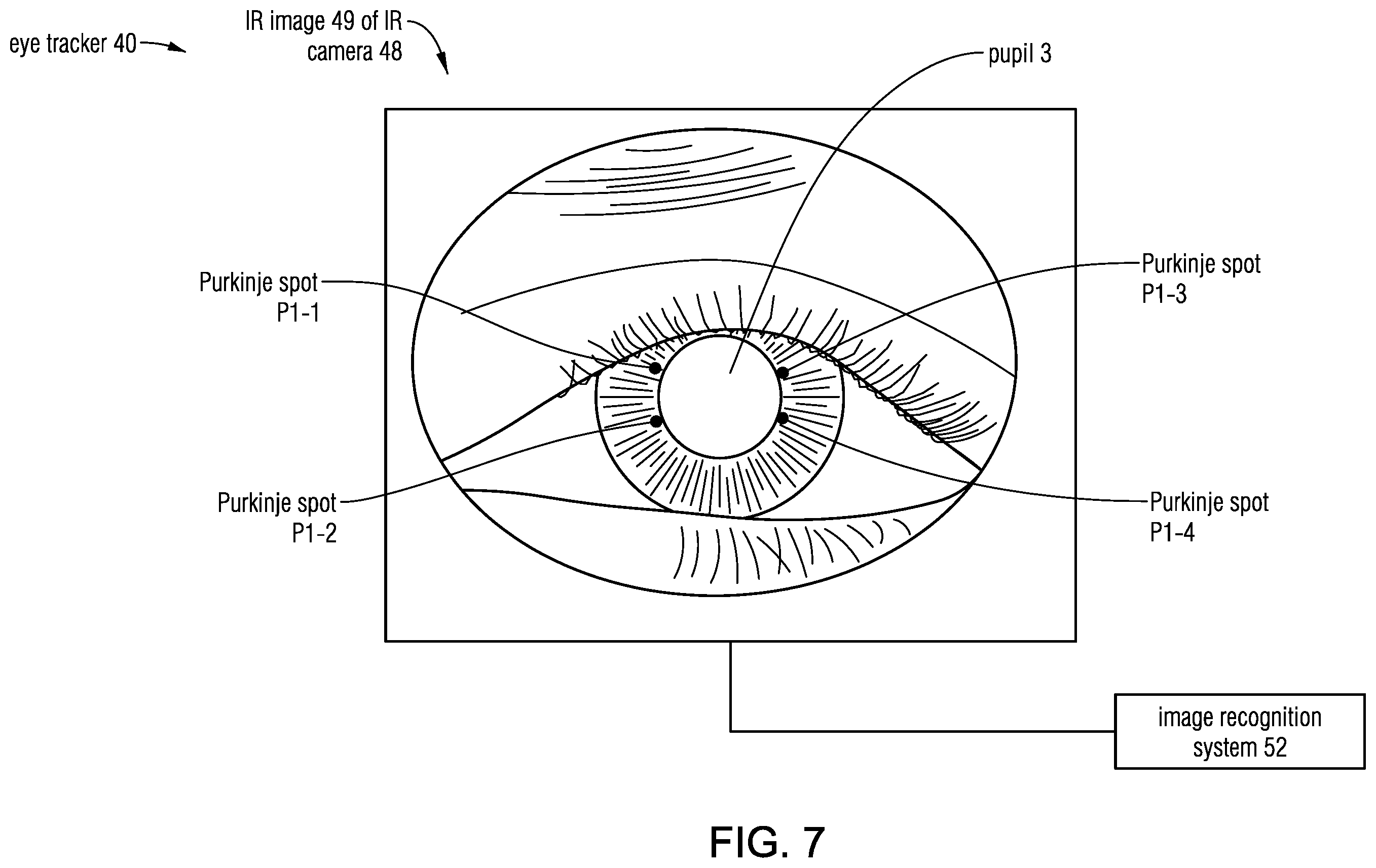 Patent US12569135 Figure 14 – Headset-based system for measuring binocular alignment