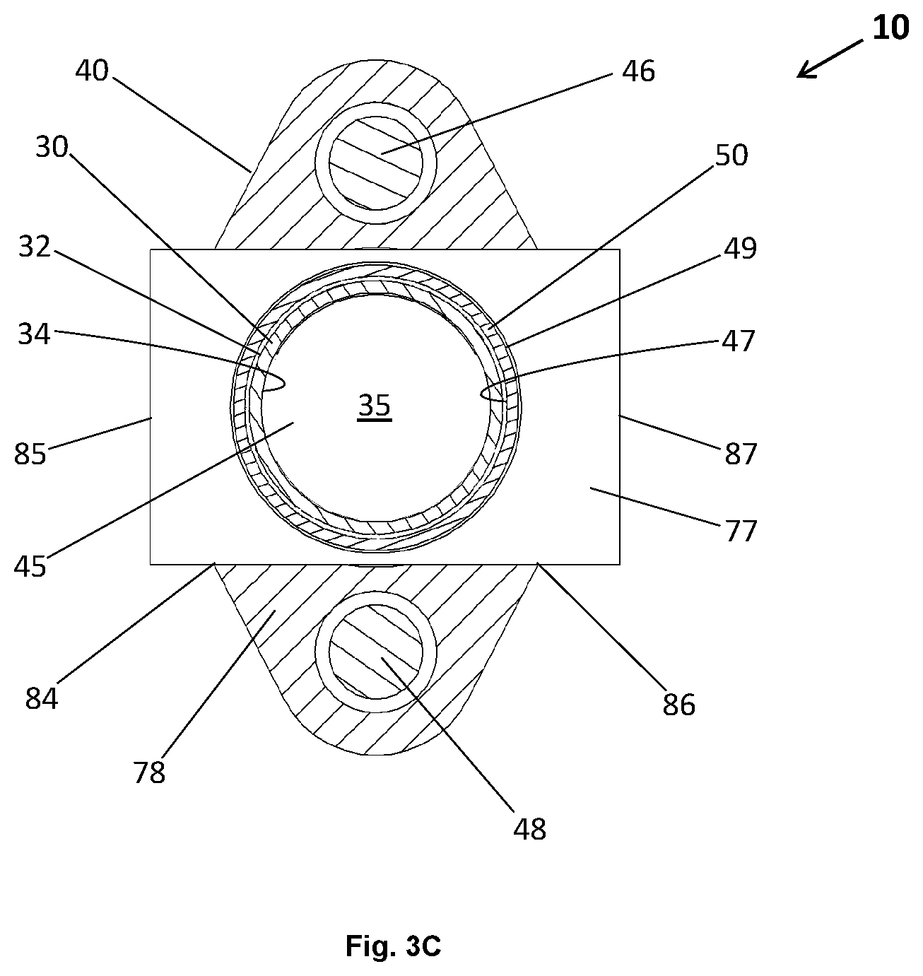 Patent US12569139 Figure 5 – Microsurgical systems for performing surgical procedures