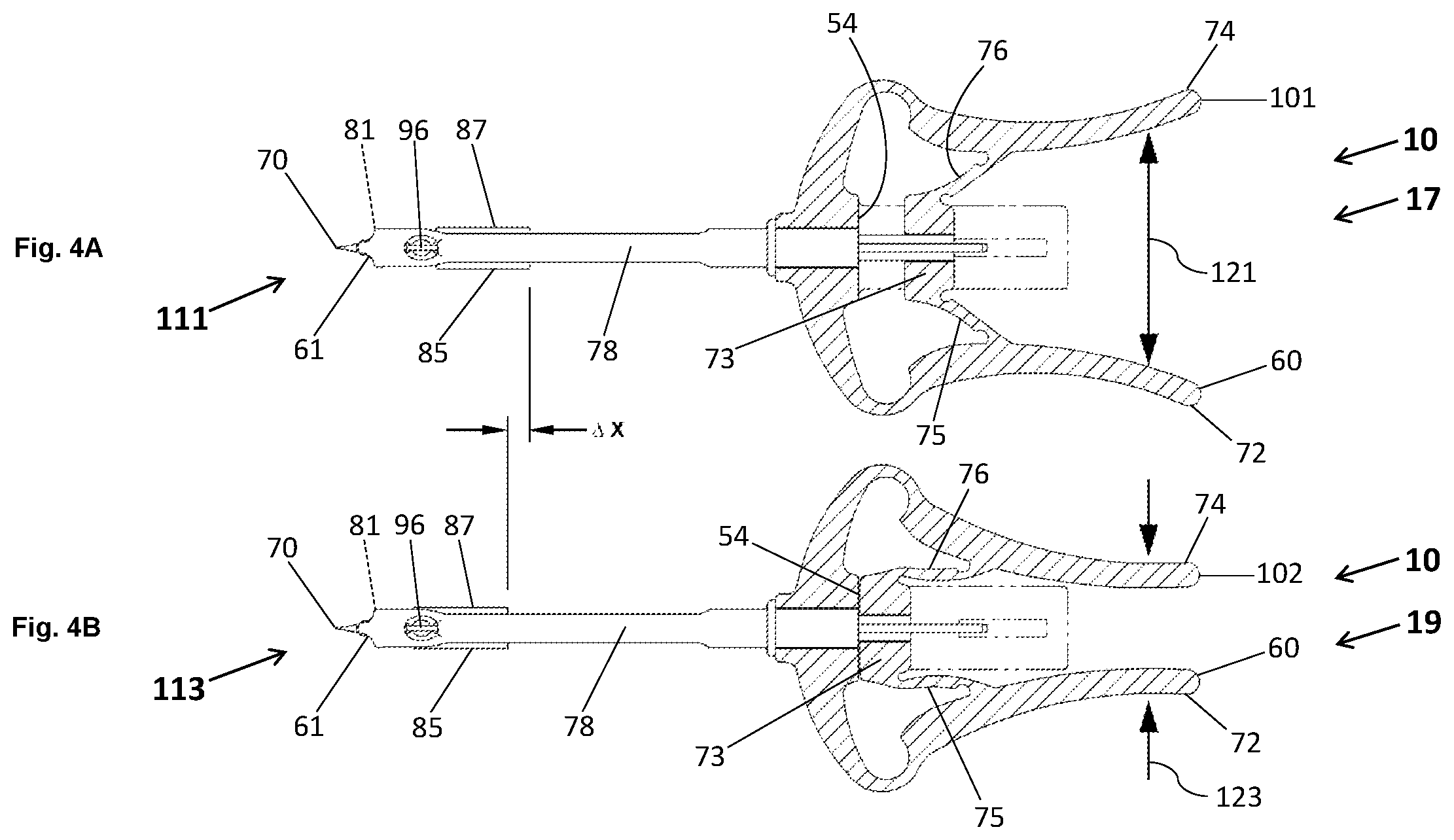 Patent US12569139 Figure 7 – Microsurgical systems for performing surgical procedures