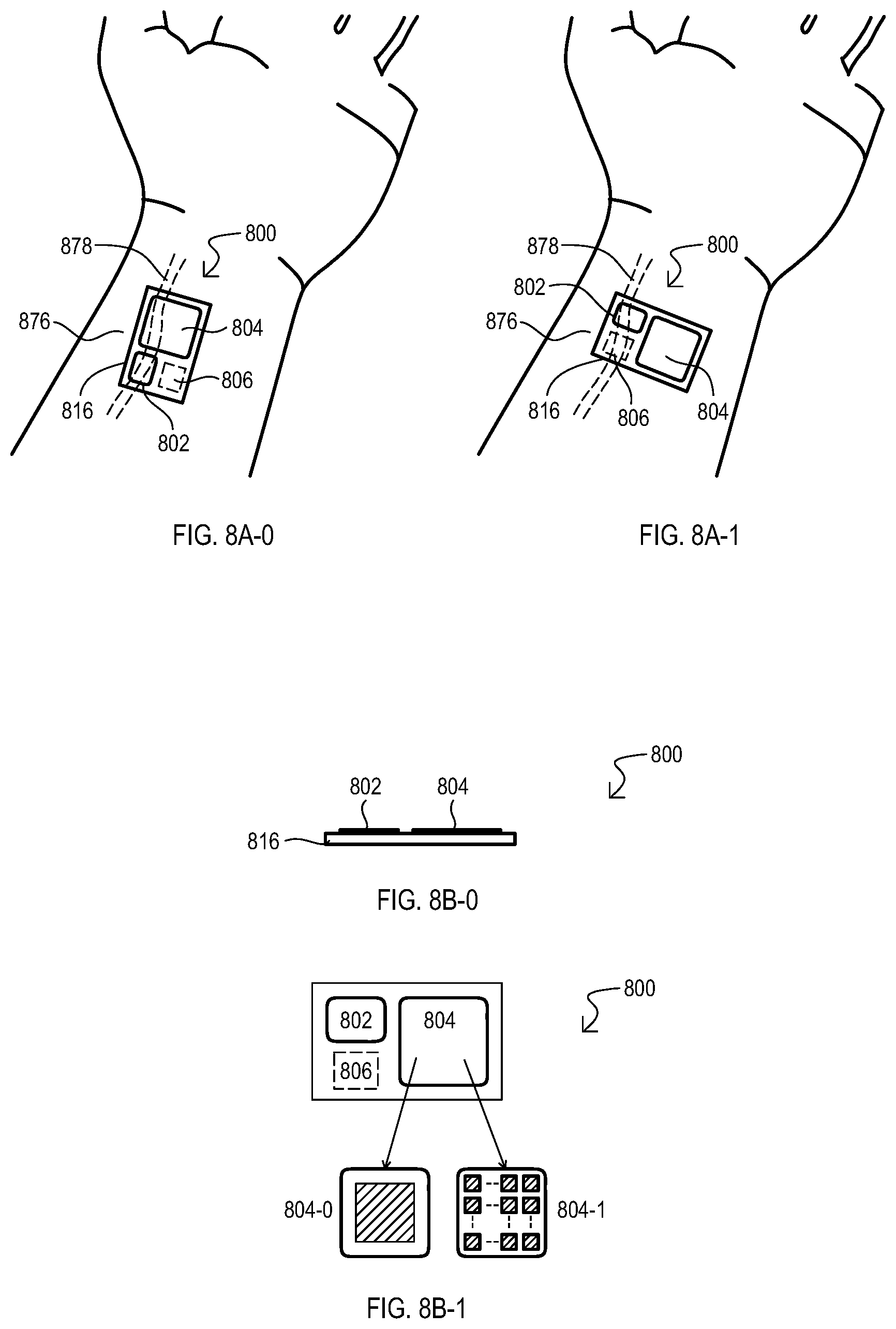 Patent US12569150 Figure 6 – Methods, devices and systems for biophysical sensing
