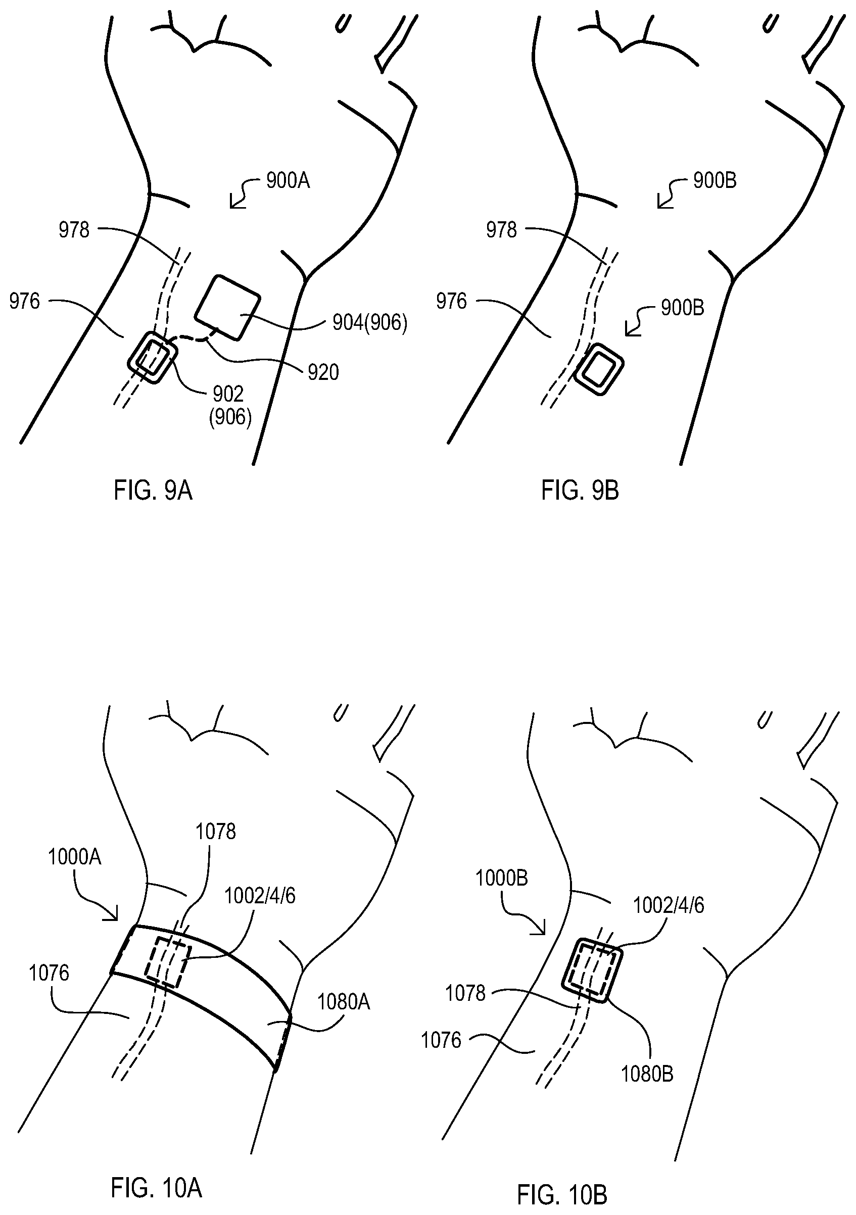 Patent US12569150 Figure 7 – Methods, devices and systems for biophysical sensing