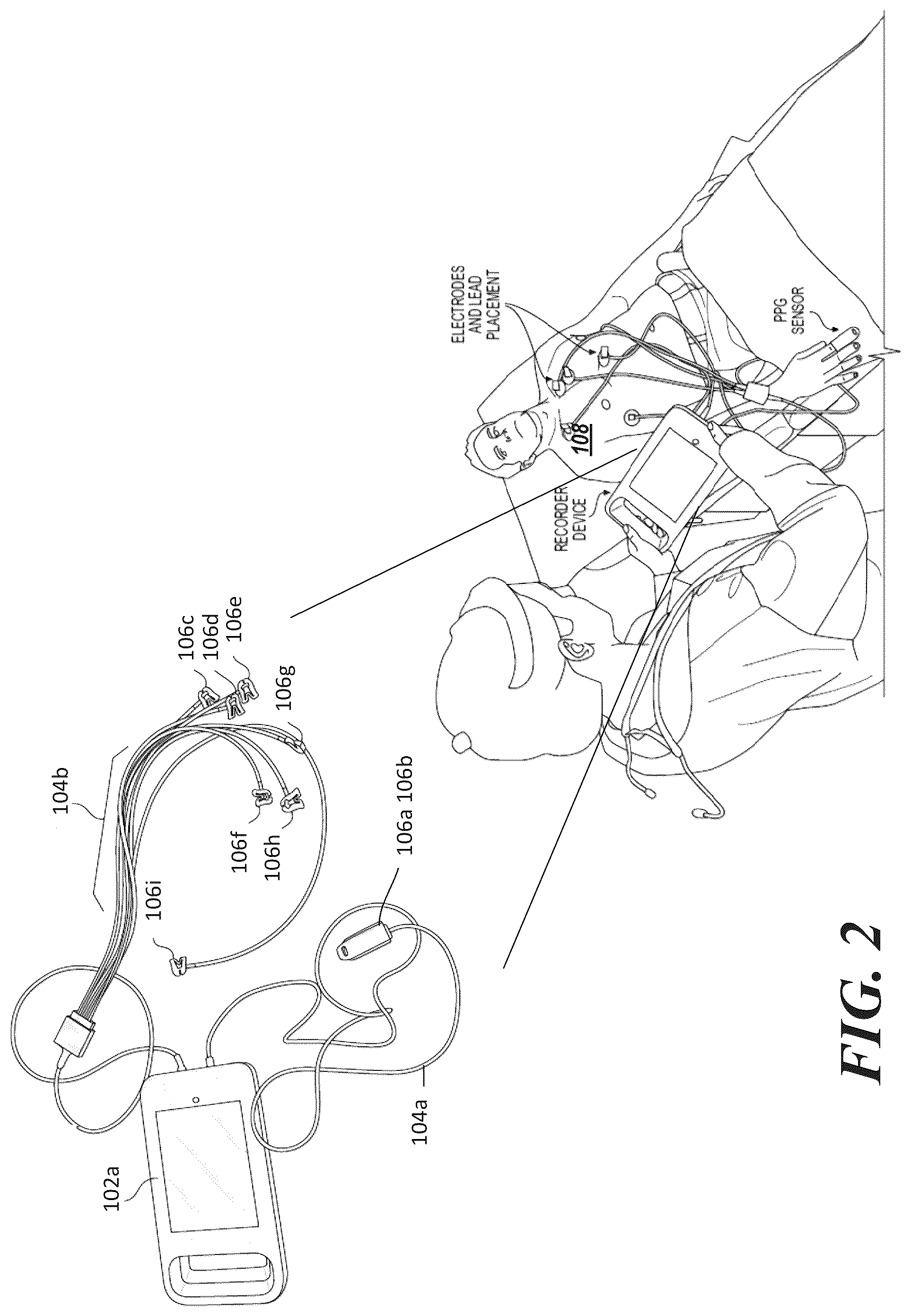 Patent US12569152 Figure 2 – Method to non-invasively assess elevated left ventricular end-diastolic pressure