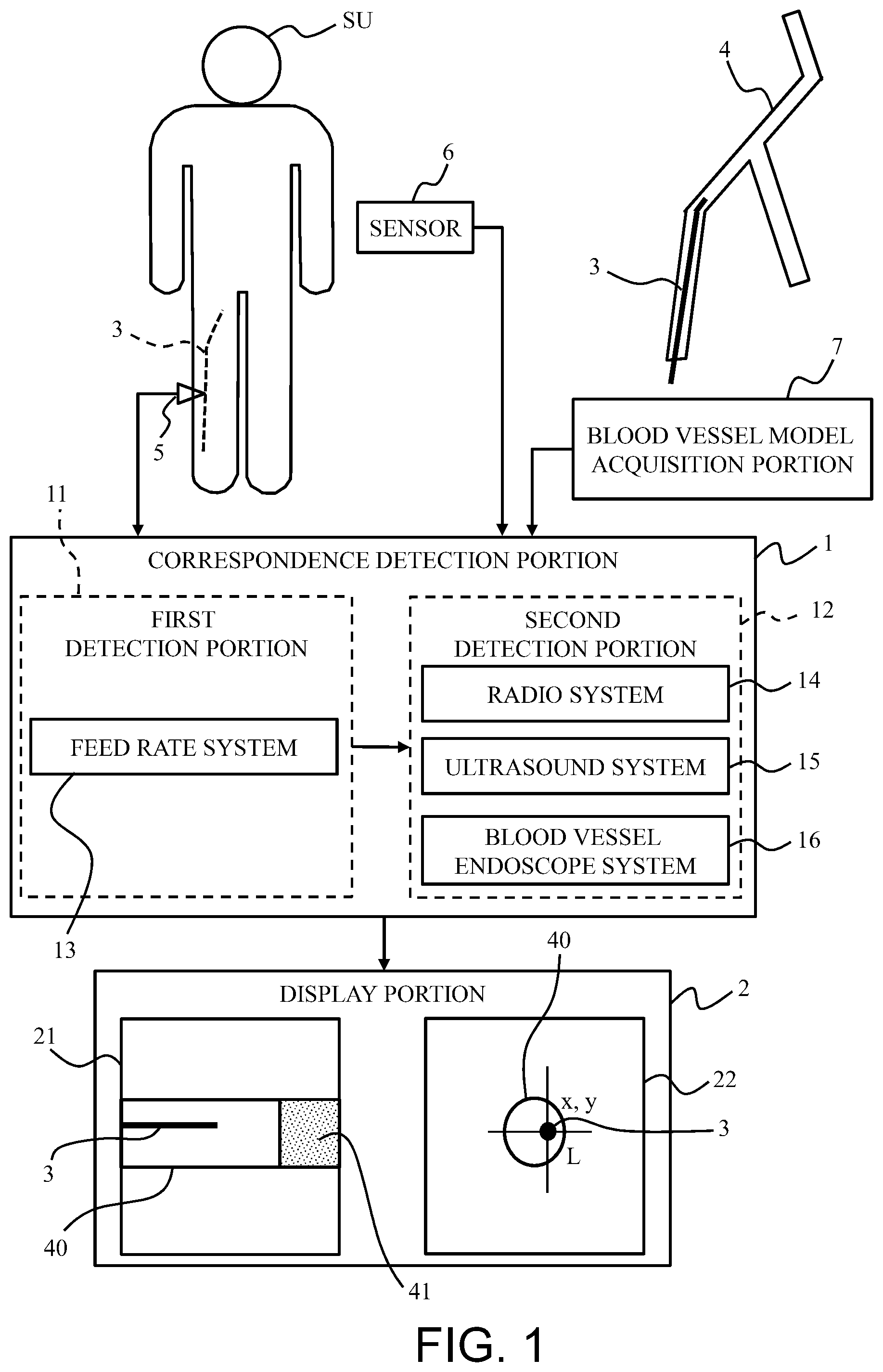 Patent US12569160 — System and method for detecting position of long medical device — Figure 1