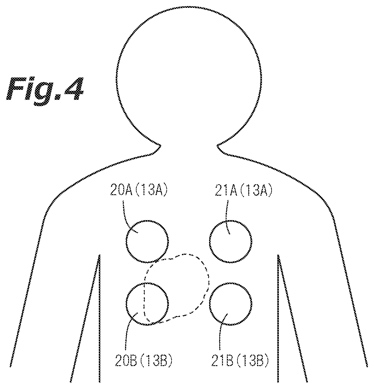 Patent US12569180 Figure 4 – Electrocardiographic signal measurement device and electrocardiographic signal measurement system technical field