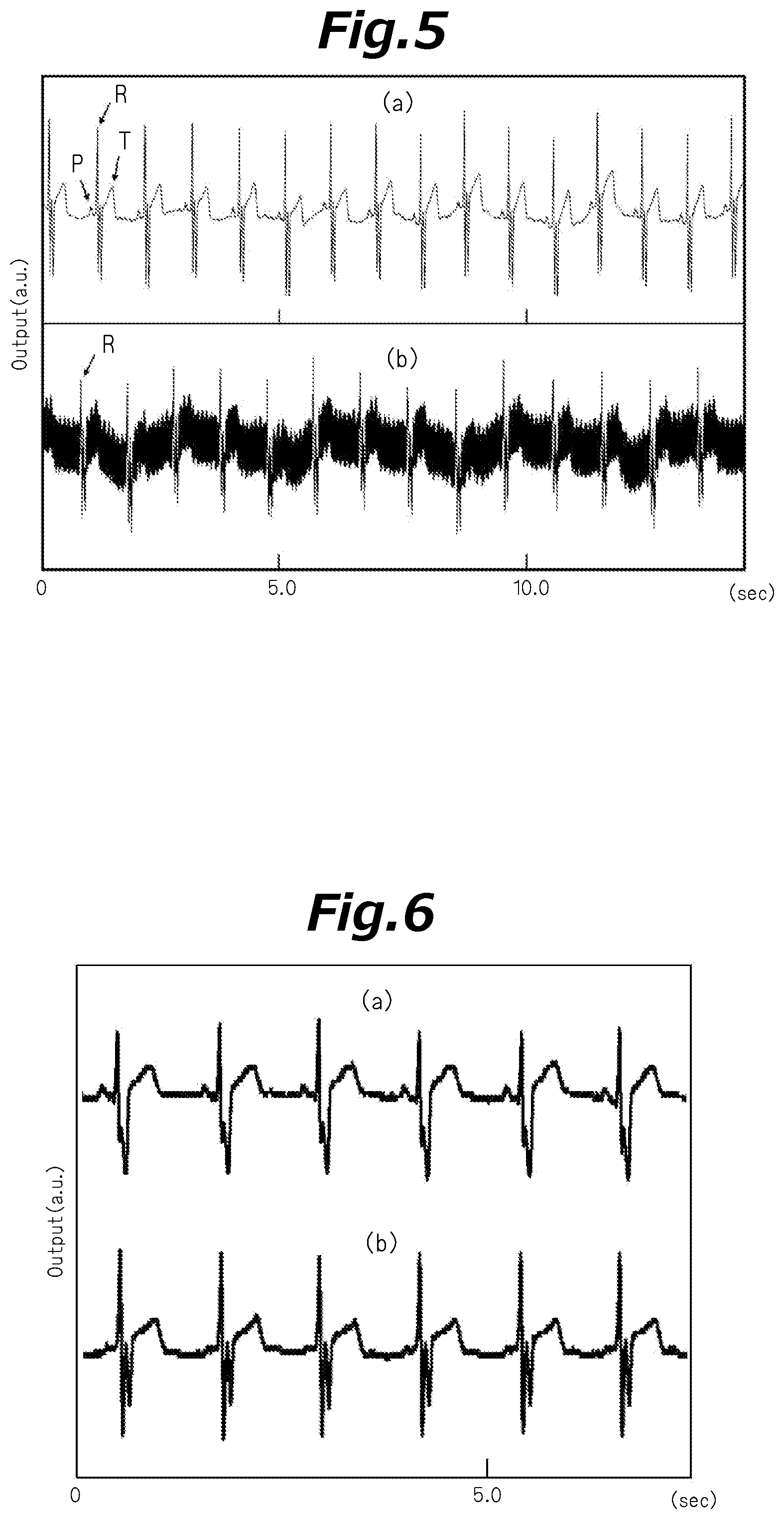 Patent US12569180 Figure 5 – Electrocardiographic signal measurement device and electrocardiographic signal measurement system technical field