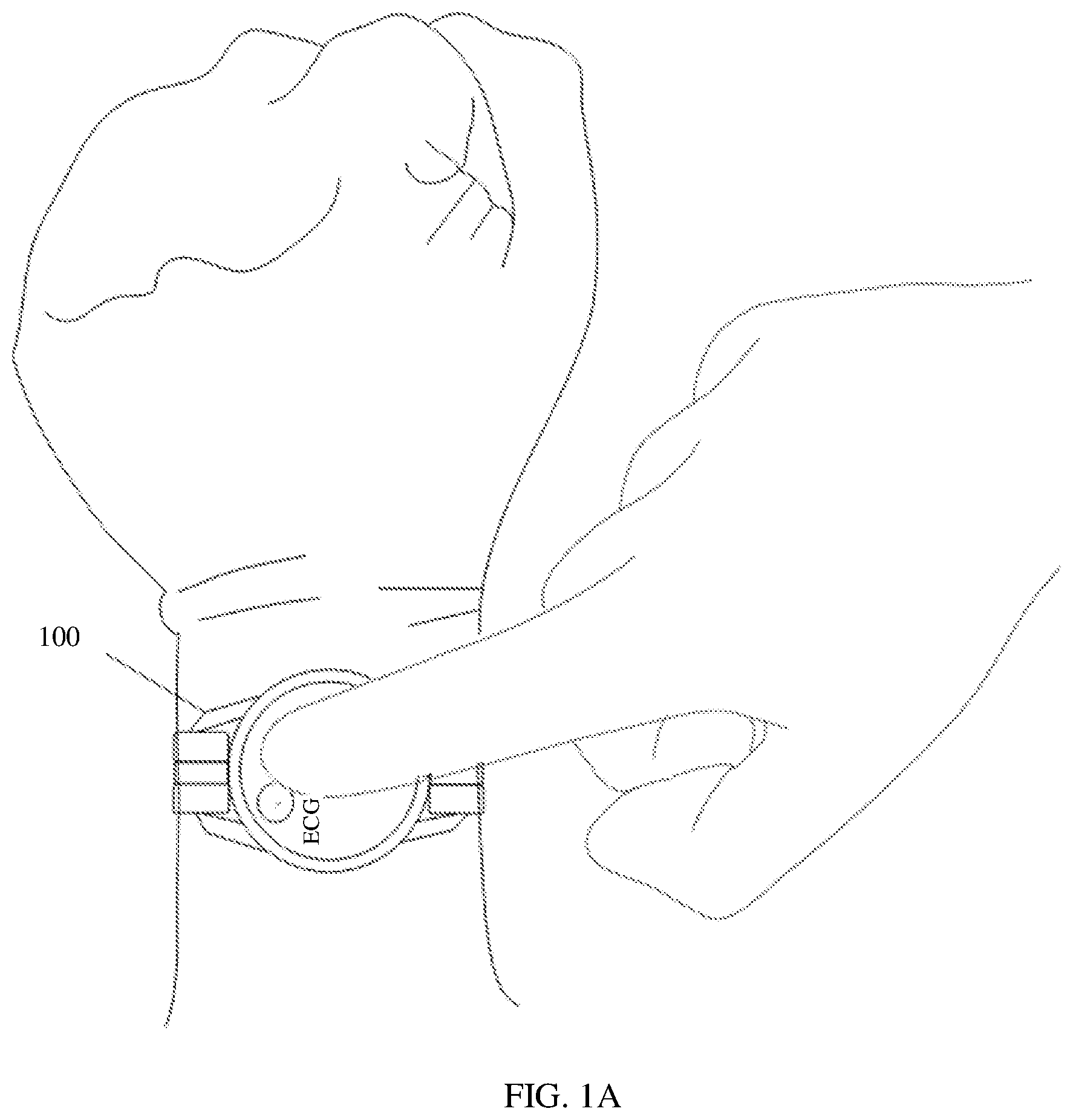 Patent US12569181 Figure 1 – ECG waveform display method and medium thereof, and electronic device