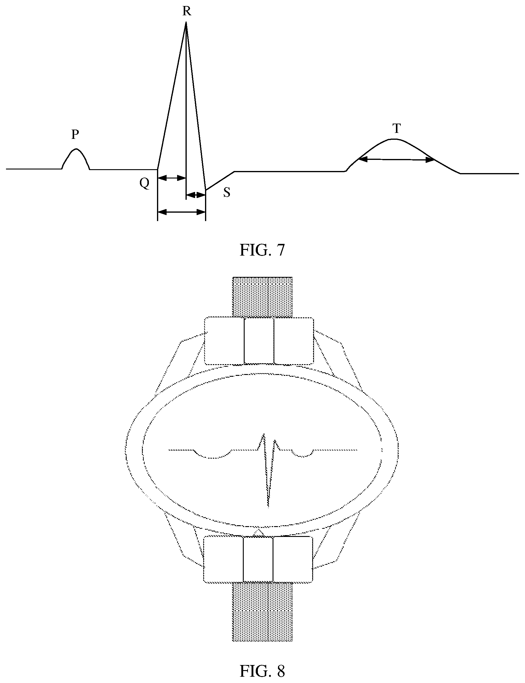 Patent US12569181 Figure 11 – ECG waveform display method and medium thereof, and electronic device