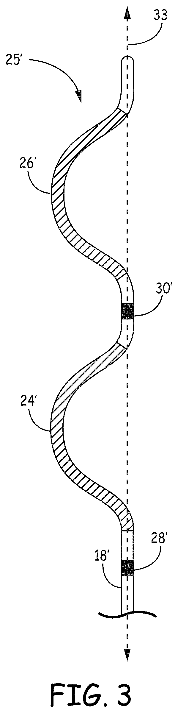 Patent US12569184 Figure 6 – Cardiac electrical signal gross morphology-based noise detection for rejection of ventricular tachyarrhythmia detection