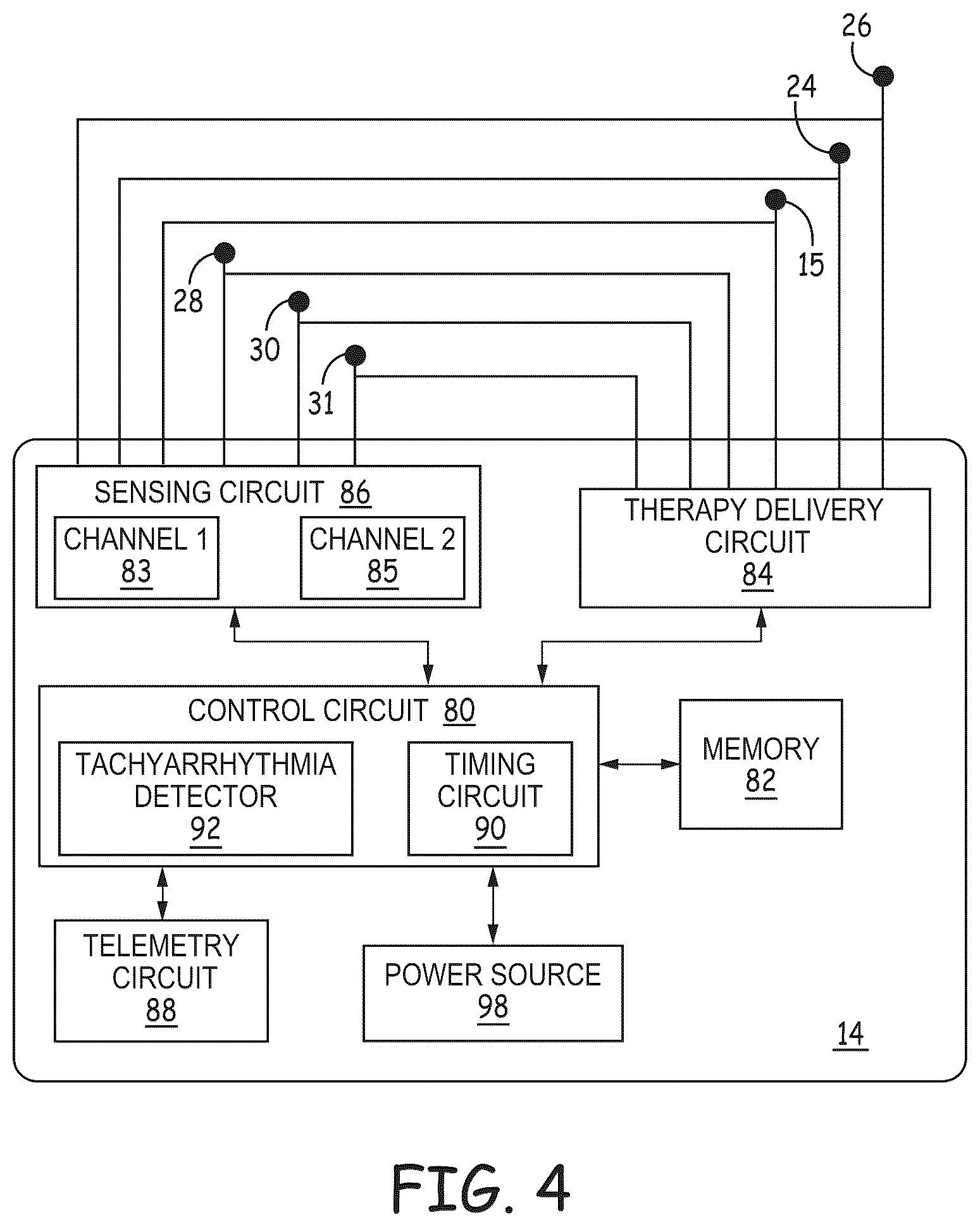 Patent US12569184 Figure 7 – Cardiac electrical signal gross morphology-based noise detection for rejection of ventricular tachyarrhythmia detection