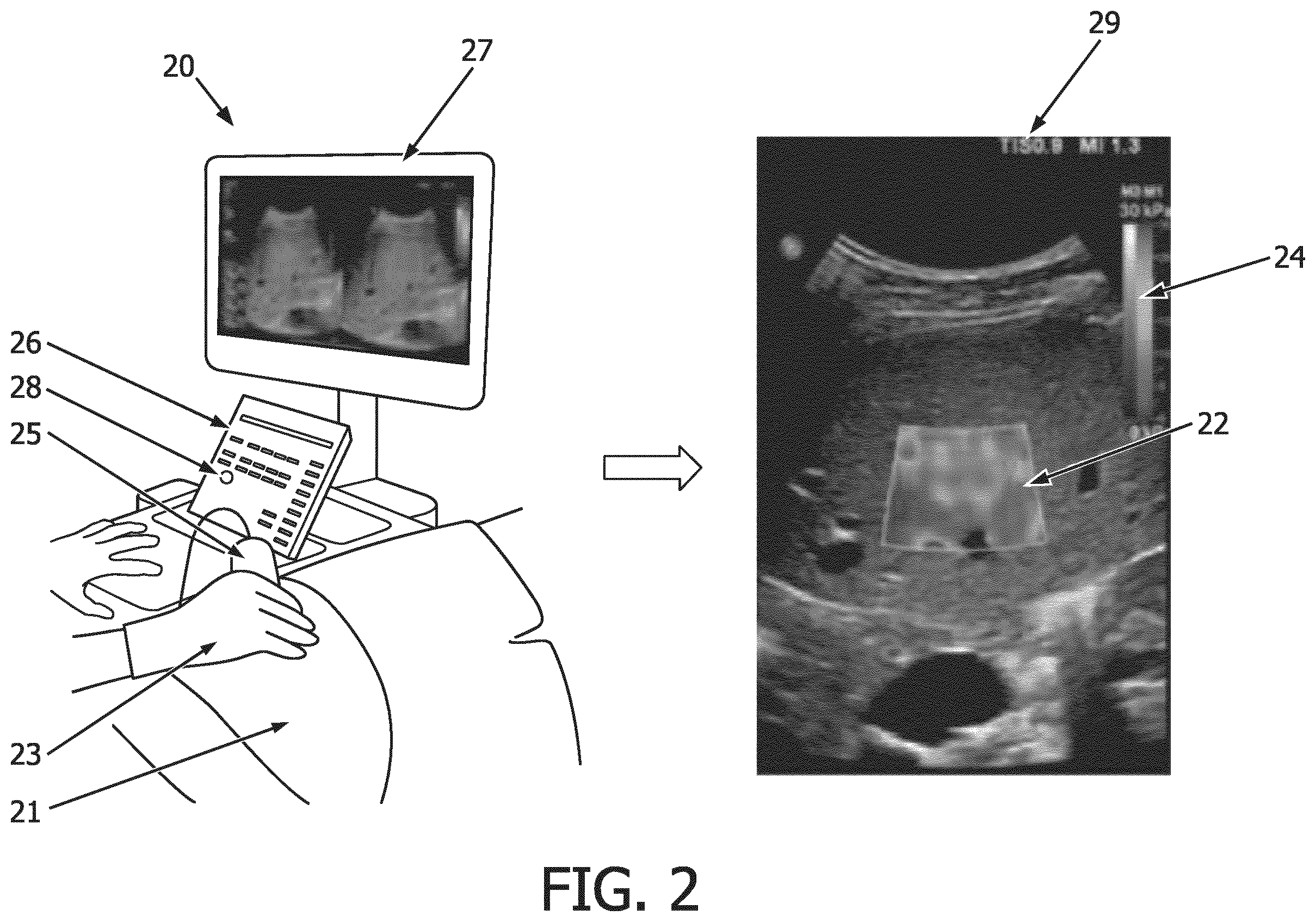 Patent US12569186 Figure 2 – Apparatus and method for augmented interpretation of magnetic resonance and ultrasound shear wave elastography for monitoring liver fibrosis
