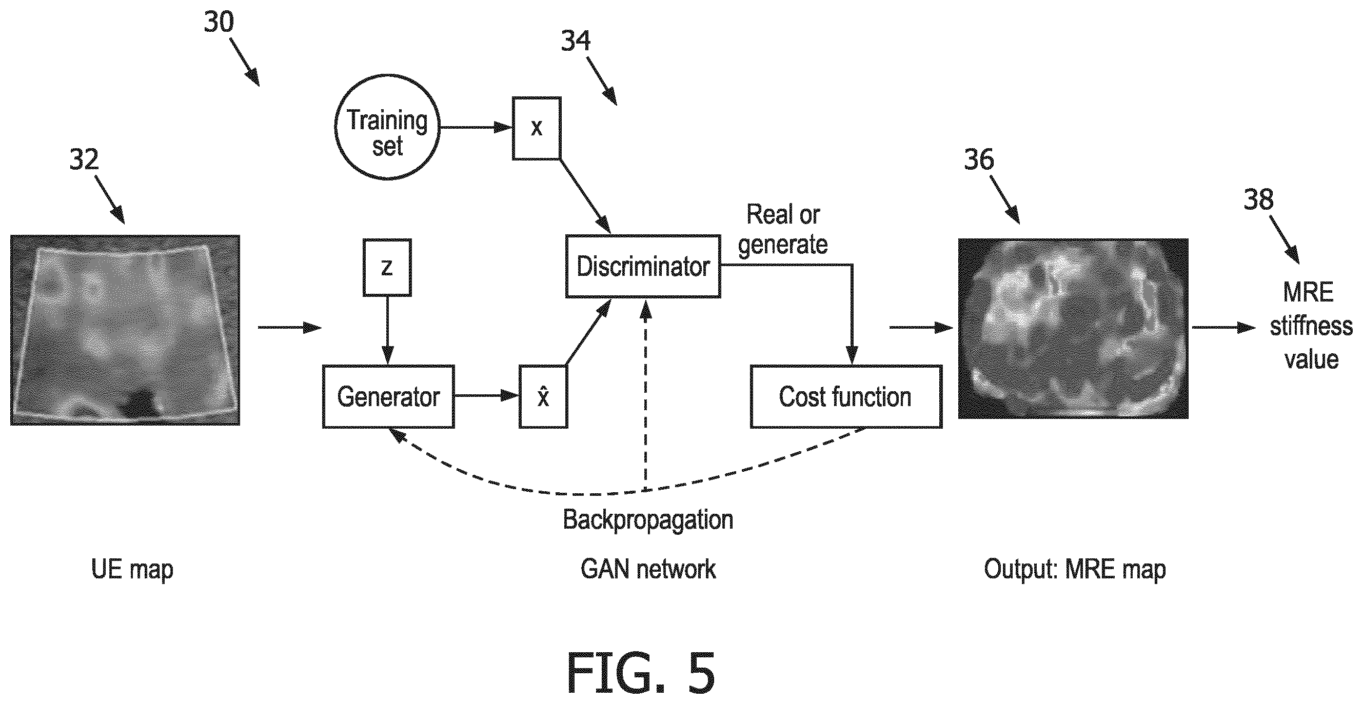 Patent US12569186 Figure 5 – Apparatus and method for augmented interpretation of magnetic resonance and ultrasound shear wave elastography for monitoring liver fibrosis