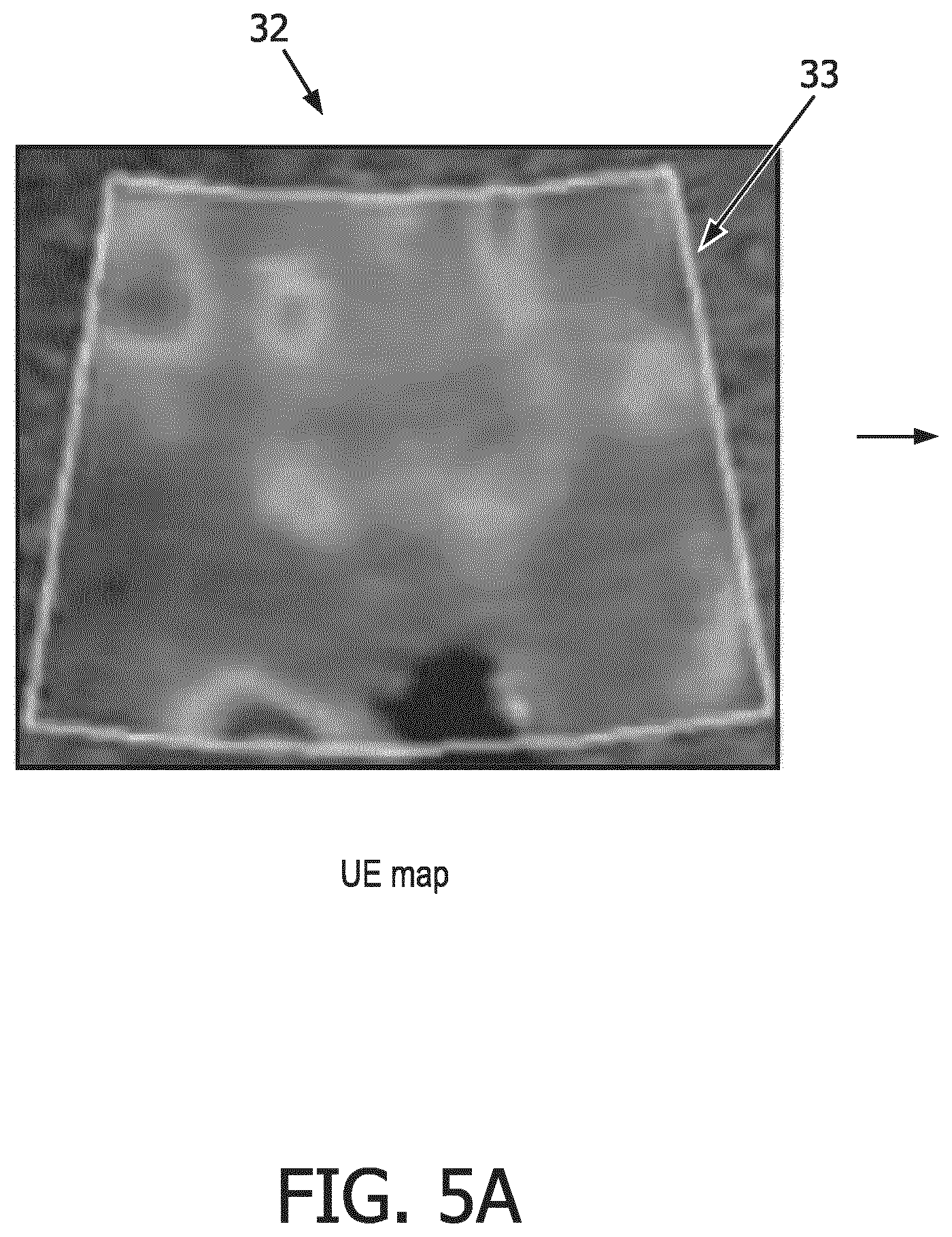 Patent US12569186 Figure 6 – Apparatus and method for augmented interpretation of magnetic resonance and ultrasound shear wave elastography for monitoring liver fibrosis