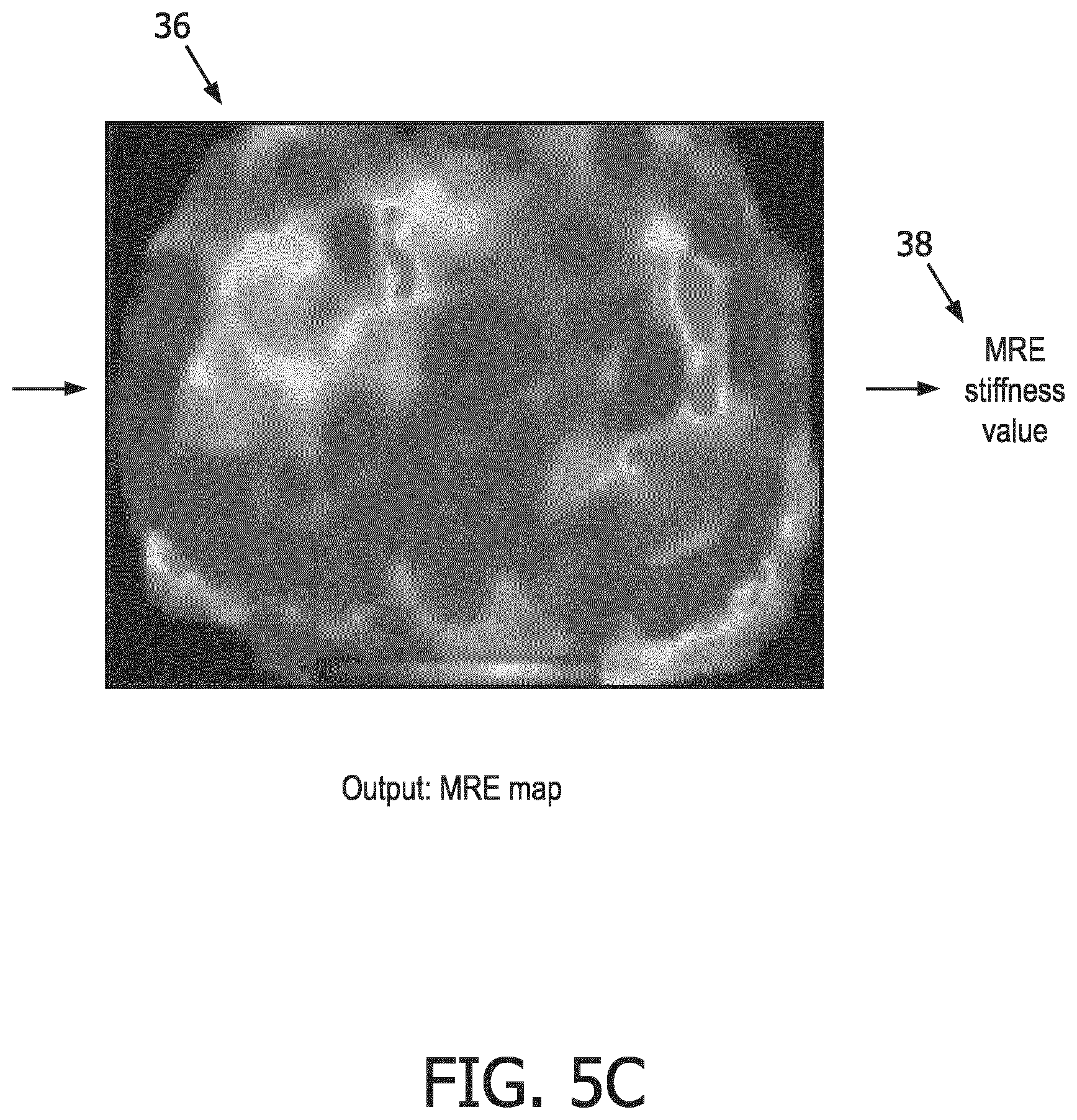 Patent US12569186 Figure 8 – Apparatus and method for augmented interpretation of magnetic resonance and ultrasound shear wave elastography for monitoring liver fibrosis