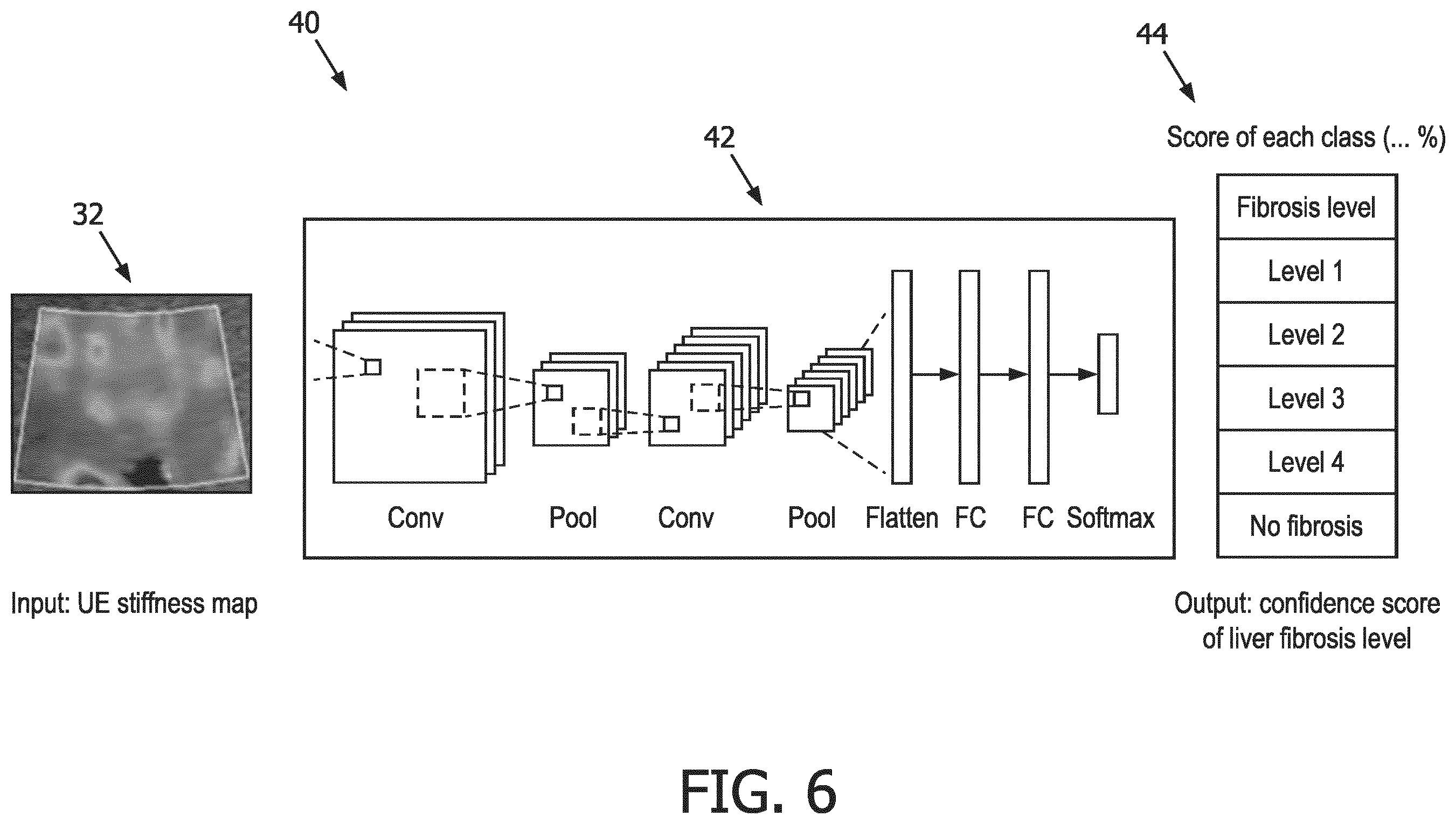 Patent US12569186 Figure 9 – Apparatus and method for augmented interpretation of magnetic resonance and ultrasound shear wave elastography for monitoring liver fibrosis