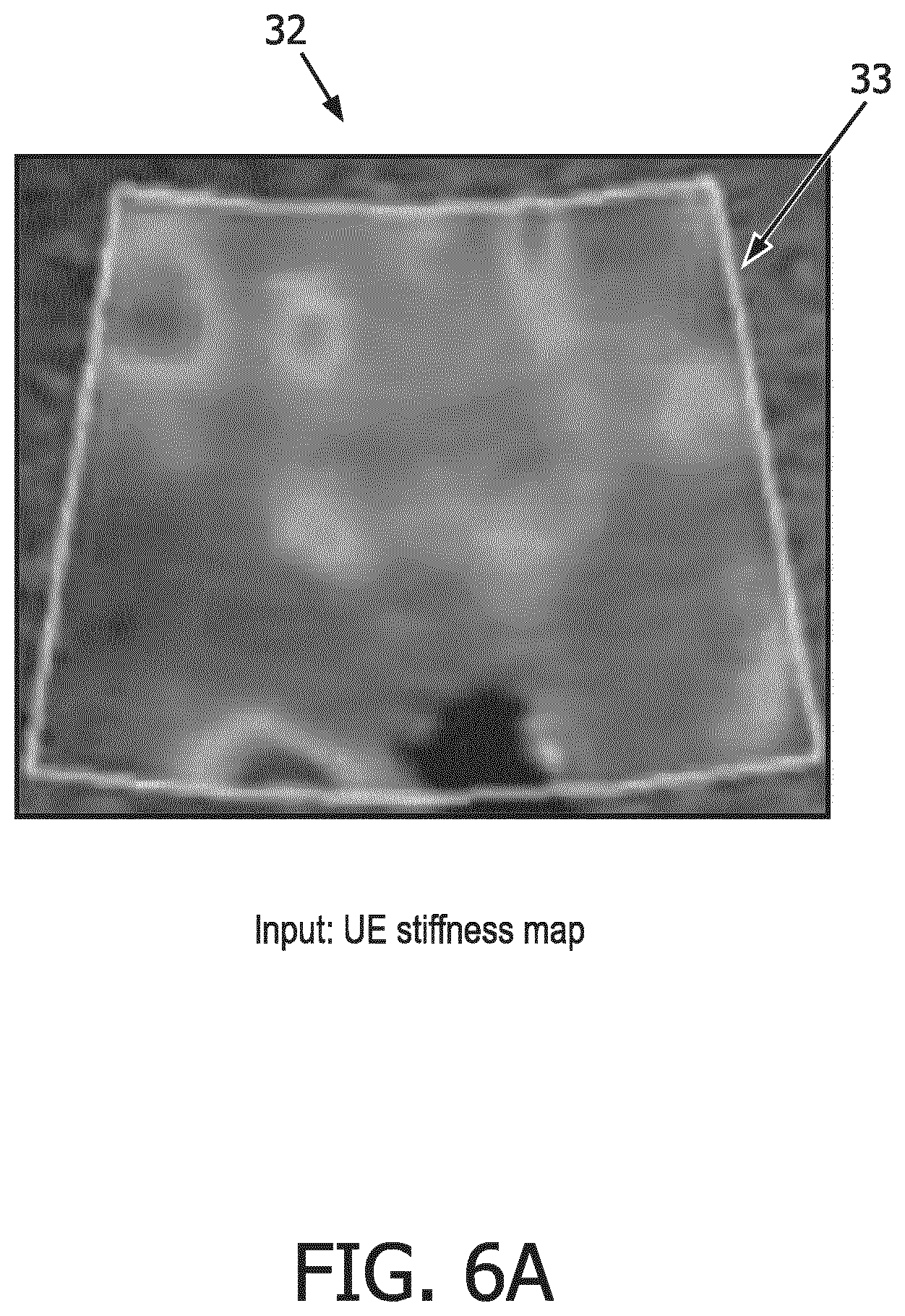 Patent US12569186 Figure 10 – Apparatus and method for augmented interpretation of magnetic resonance and ultrasound shear wave elastography for monitoring liver fibrosis