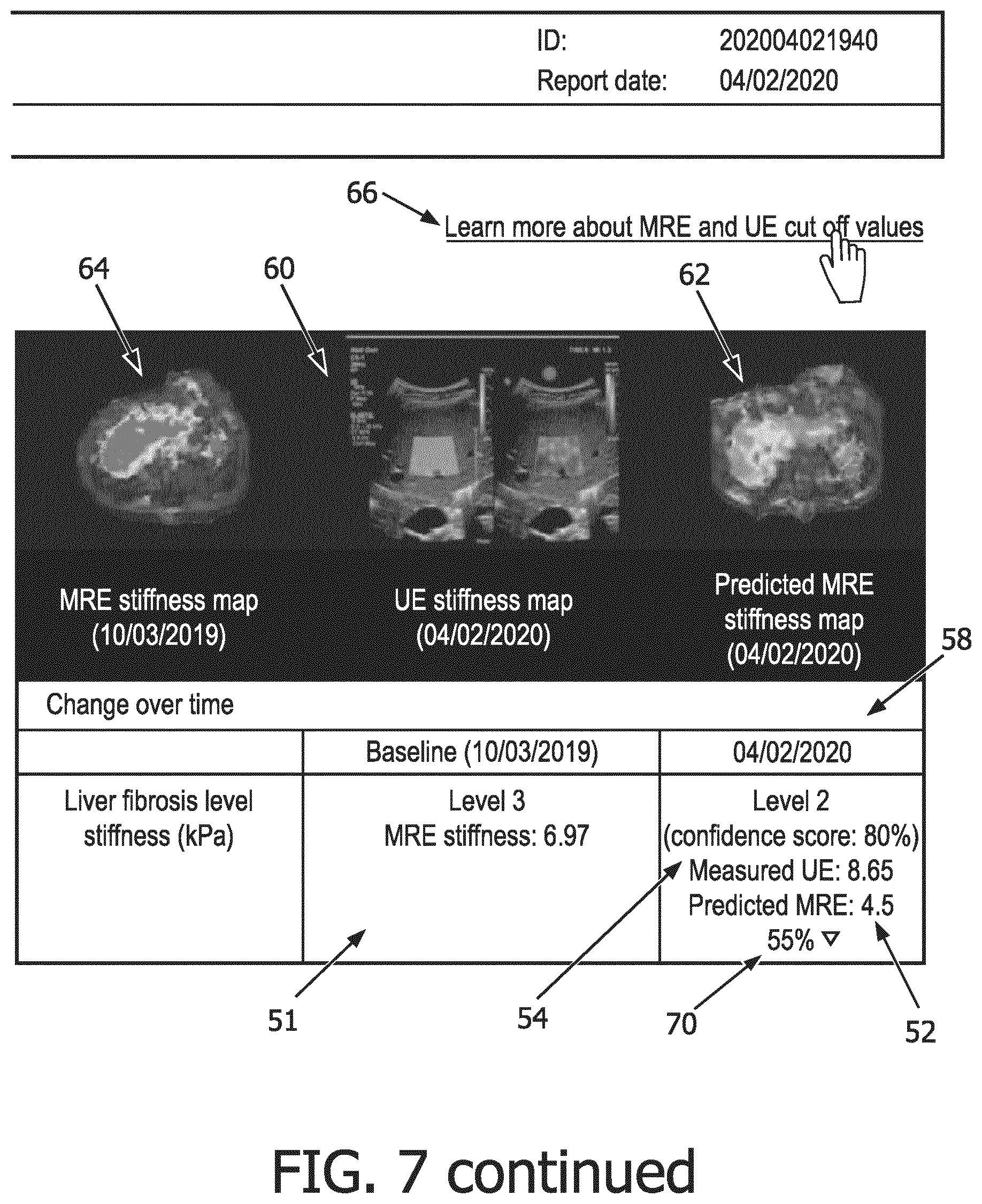 Patent US12569186 Figure 14 – Apparatus and method for augmented interpretation of magnetic resonance and ultrasound shear wave elastography for monitoring liver fibrosis