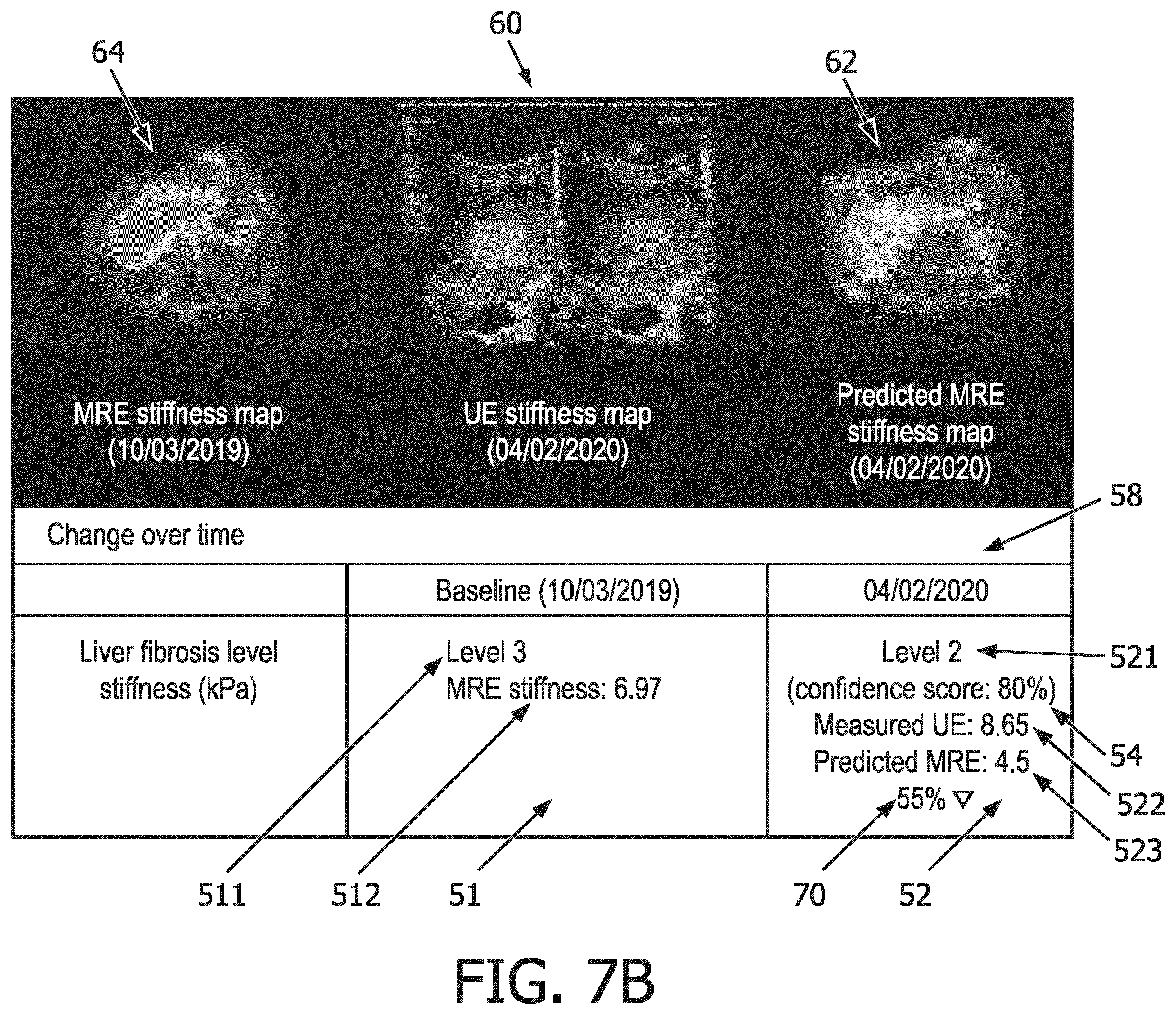 Patent US12569186 Figure 16 – Apparatus and method for augmented interpretation of magnetic resonance and ultrasound shear wave elastography for monitoring liver fibrosis