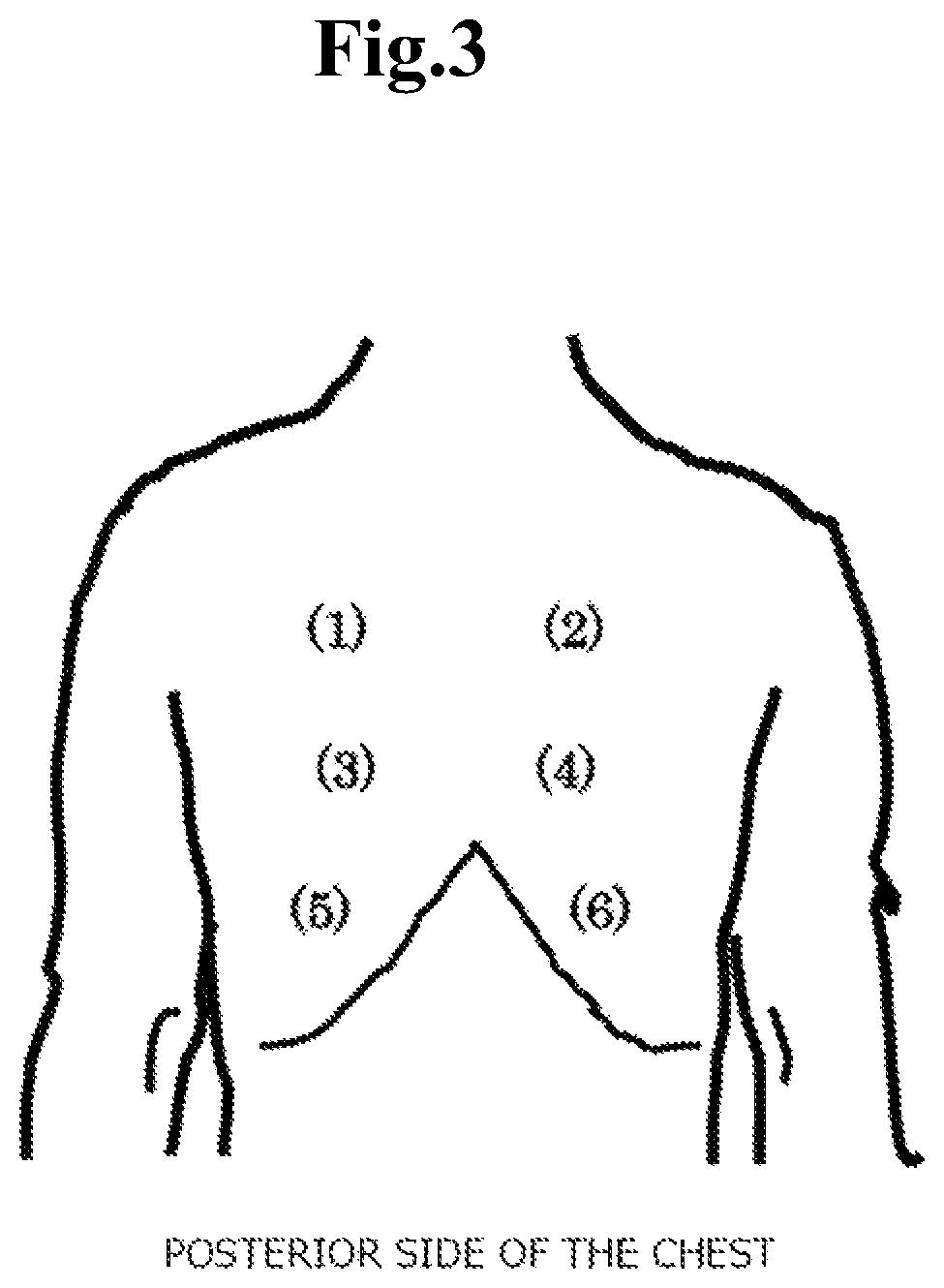 Patent US12569192 Figure 3 – Analysis device