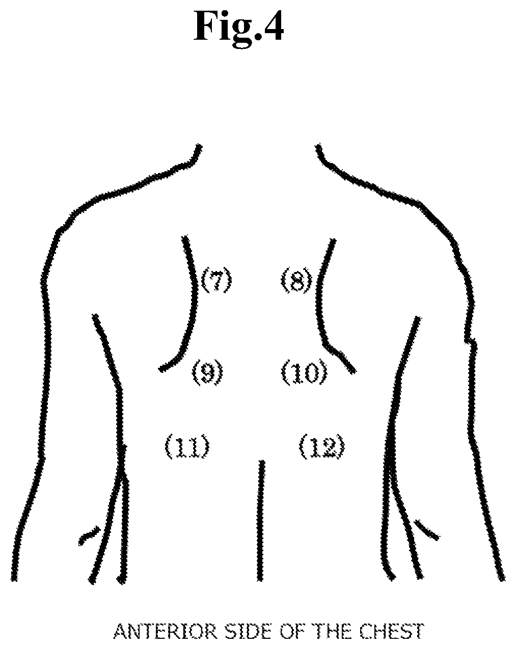 Patent US12569192 Figure 4 – Analysis device
