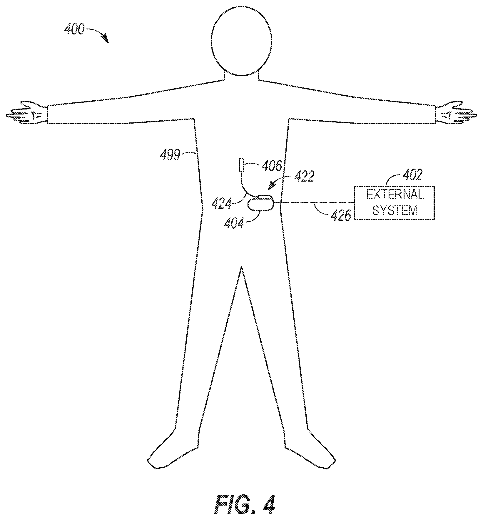 Patent US12569193 Figure 2 – Neurostimulation programming and triage based on freeform text inputs