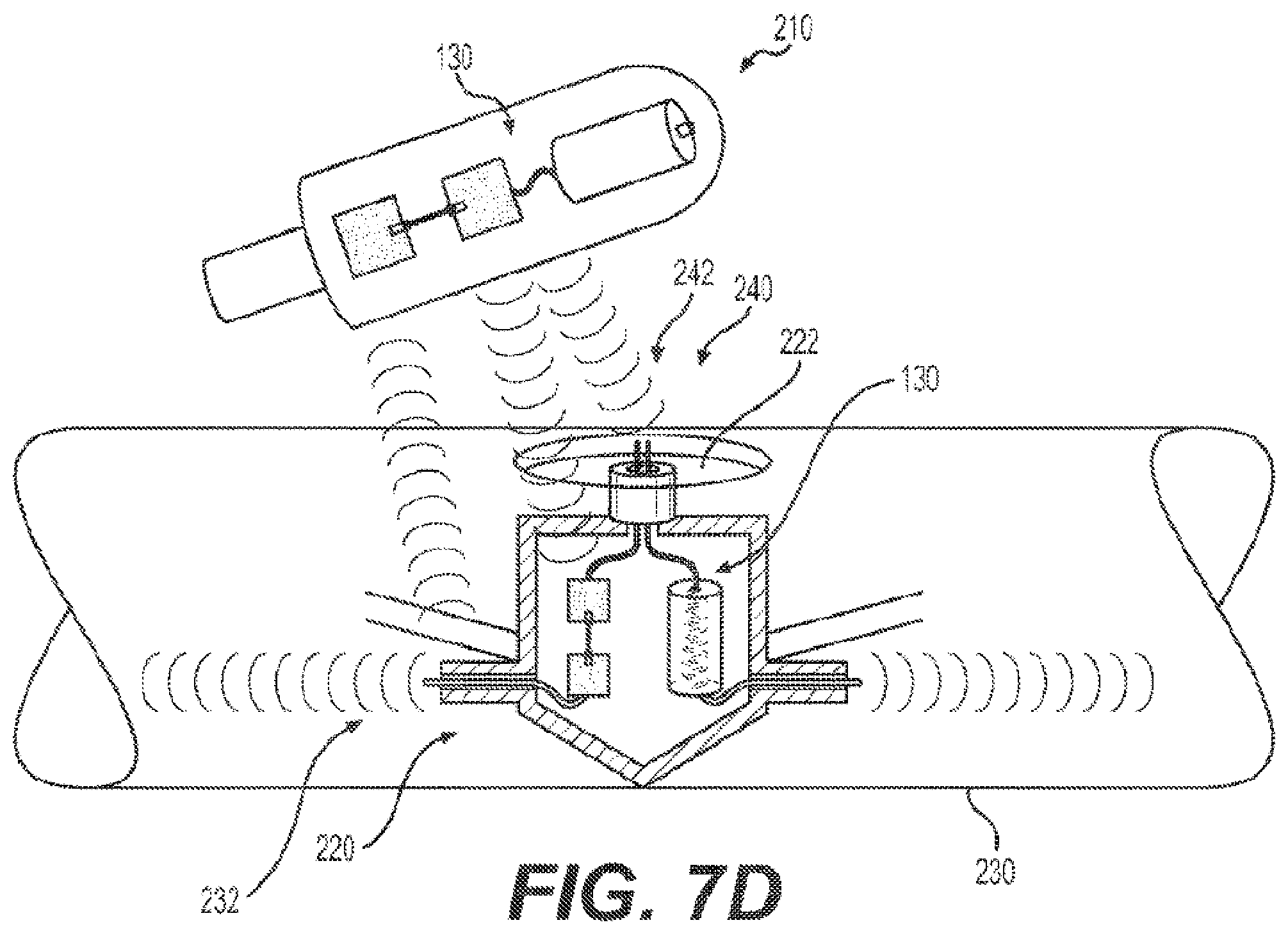Patent US12569194 Figure 9 – Medical system having a position measurement patch device for providing measurement data or a therapy