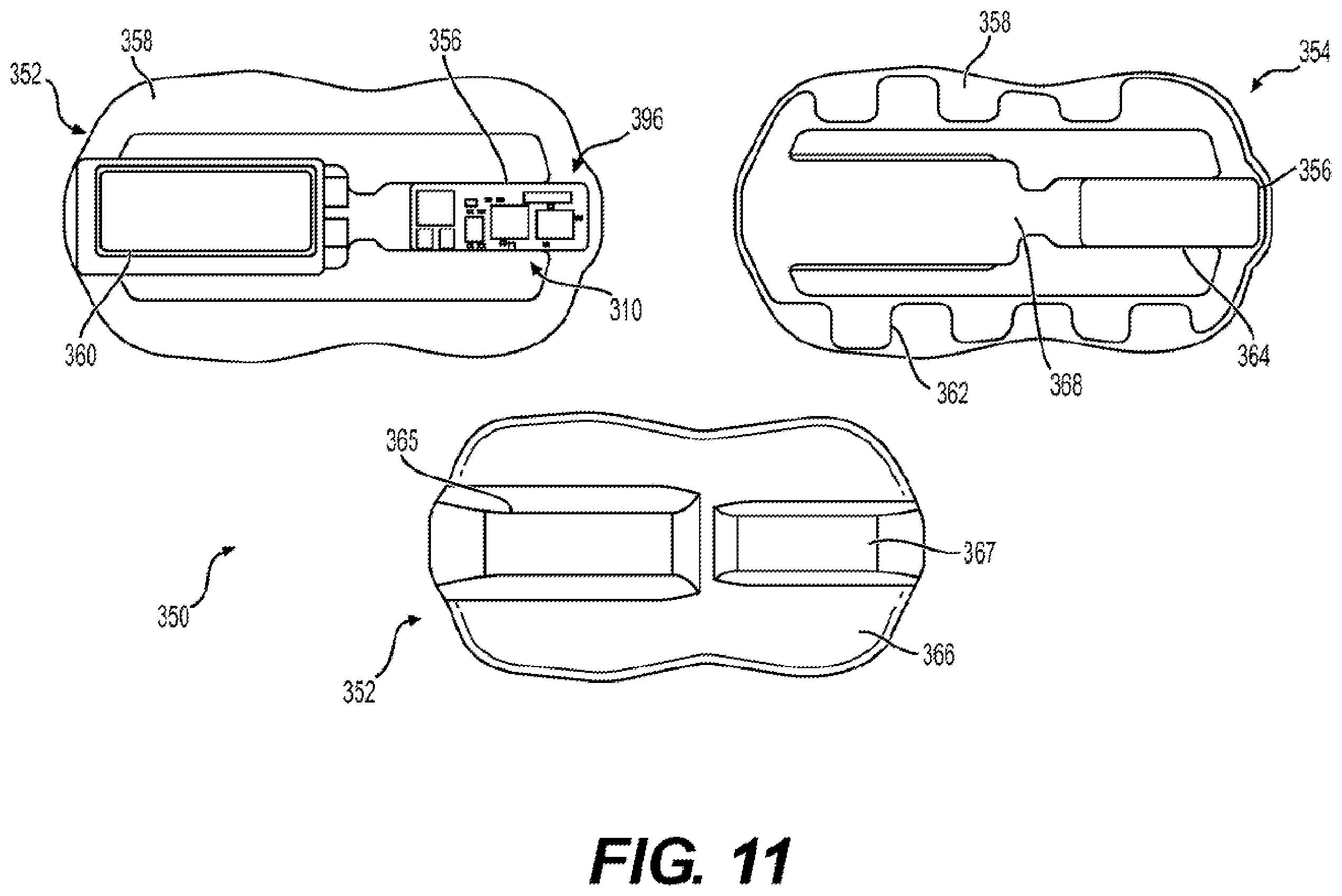 Patent US12569194 Figure 13 – Medical system having a position measurement patch device for providing measurement data or a therapy