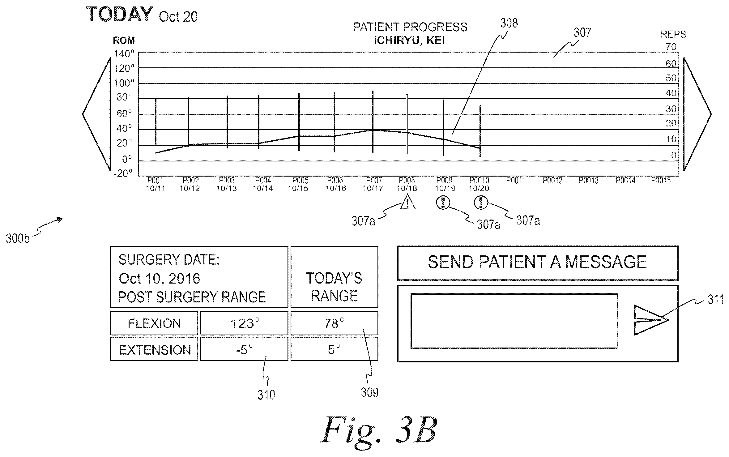 Patent US12569195 Figure 5 – Systems and methods for monitoring physical therapy of the knee and other joints
