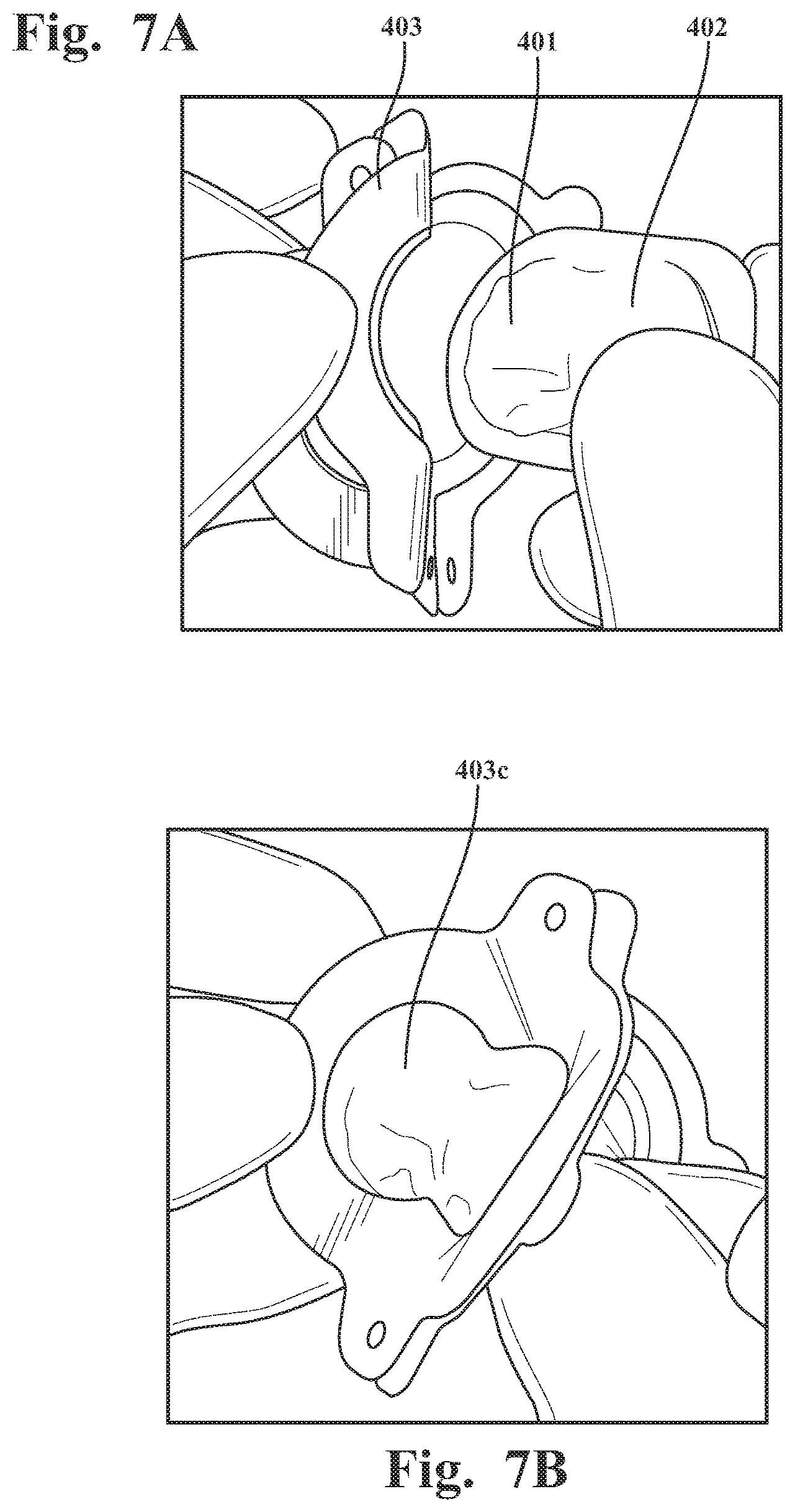 Patent US12569195 Figure 9 – Systems and methods for monitoring physical therapy of the knee and other joints