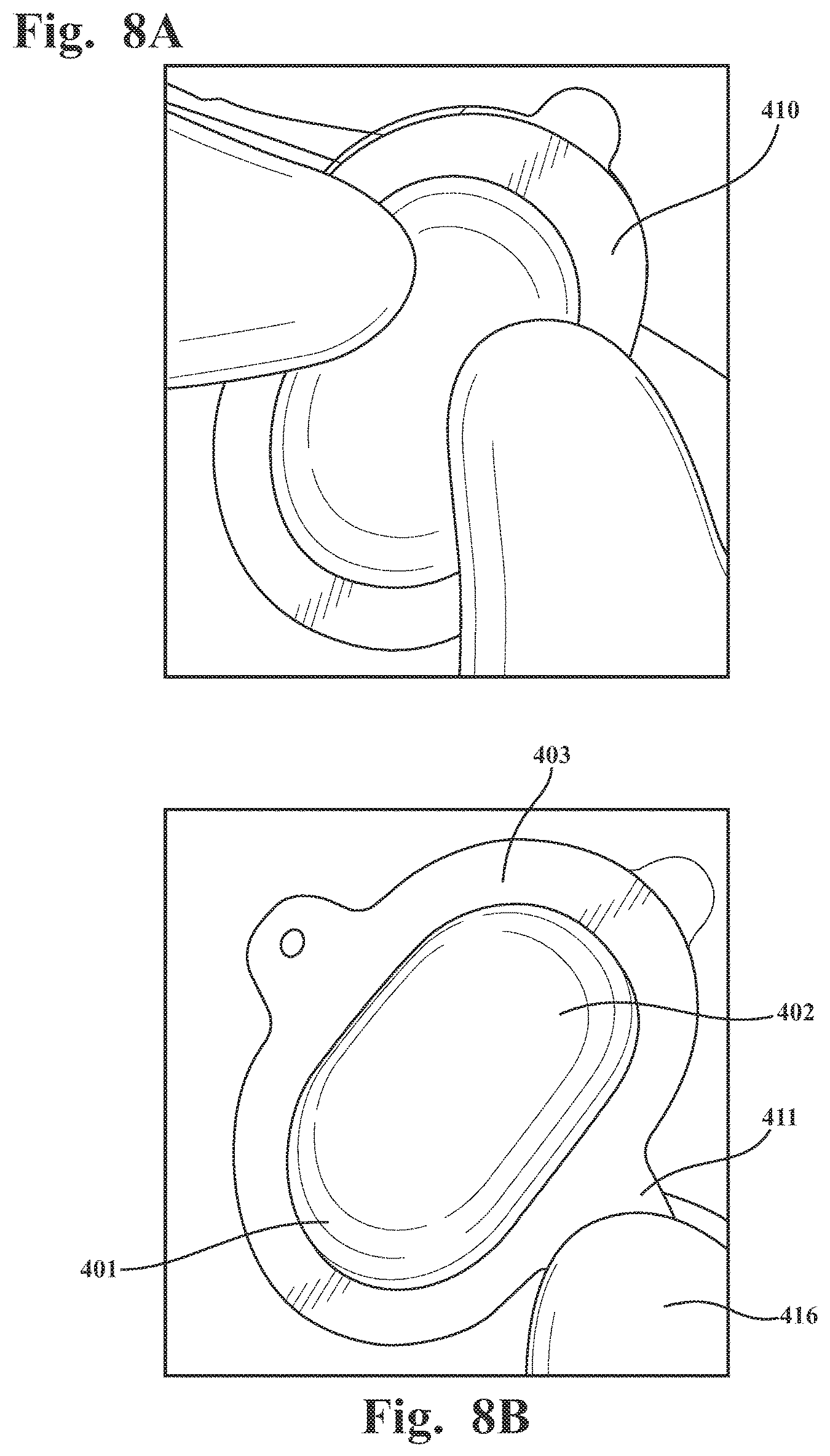 Patent US12569195 Figure 11 – Systems and methods for monitoring physical therapy of the knee and other joints